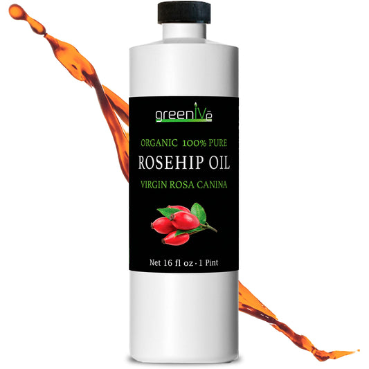 GreenIVe Organically Grown Rosehip Oil Rosa Canina 100% Pure Cold Pressed Virgin Oil Natural (16 Fl Oz)