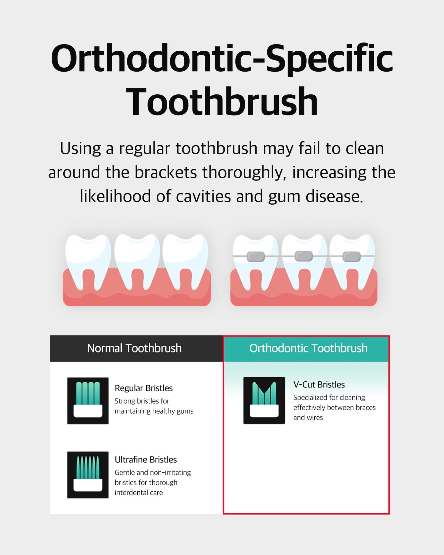 LiveOrals V-Cut Orthodontic Toothbrush (Mint 3 Units + White 3 Units) - Compact Head for Braces, Ergonomic Handle, Deep Cleaning, Gentle Bristles for Brackets and Wires