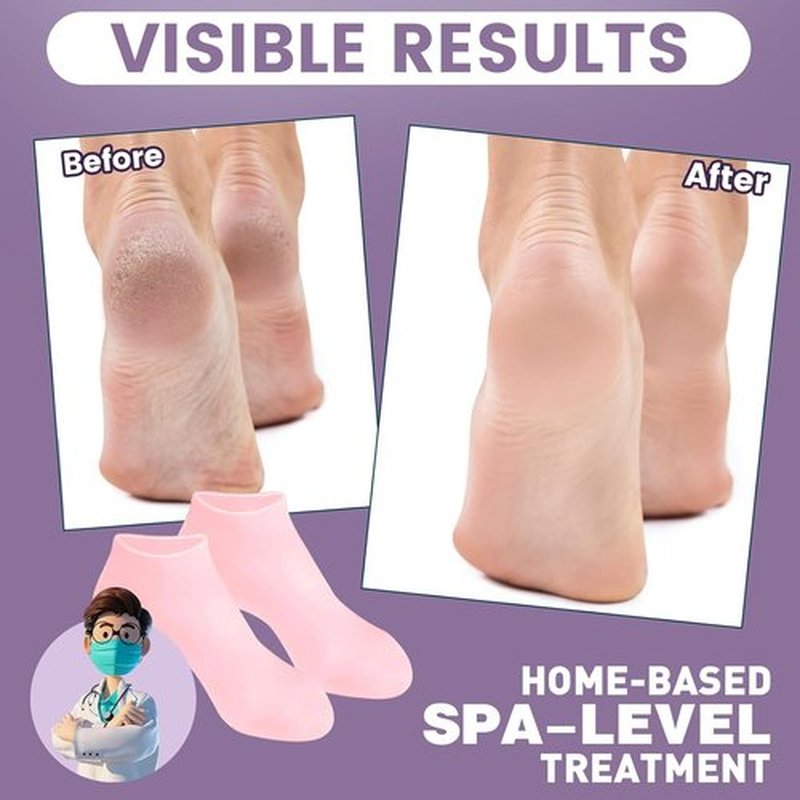 5 Pairs Silicone Socks for Dry Cracked Feet - Women's Moisturizing Foot Socks, Cracked Heel Treatment (5 Colors Assorted, Fits Up to Size 9)