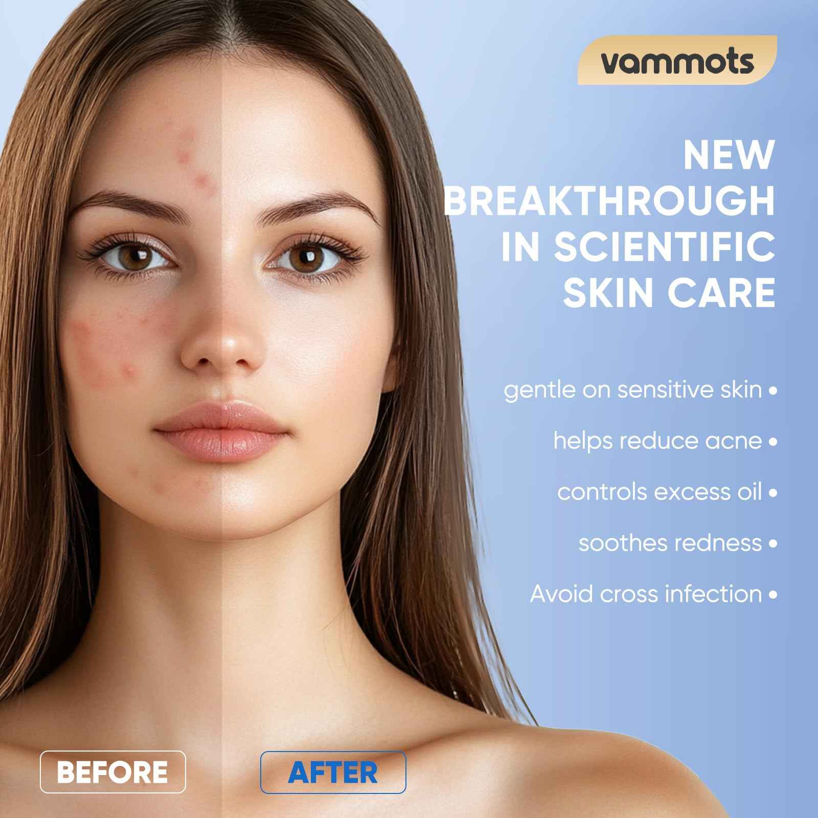 vammots Disposable Face Towels,Biodegradable Ultra Soft Washcloths for Sensitive Skin,Suitable for Facial Cleansing,Skin care and Makeup Removal,Lint-free,Trave,Daily Cleansing,600 Count