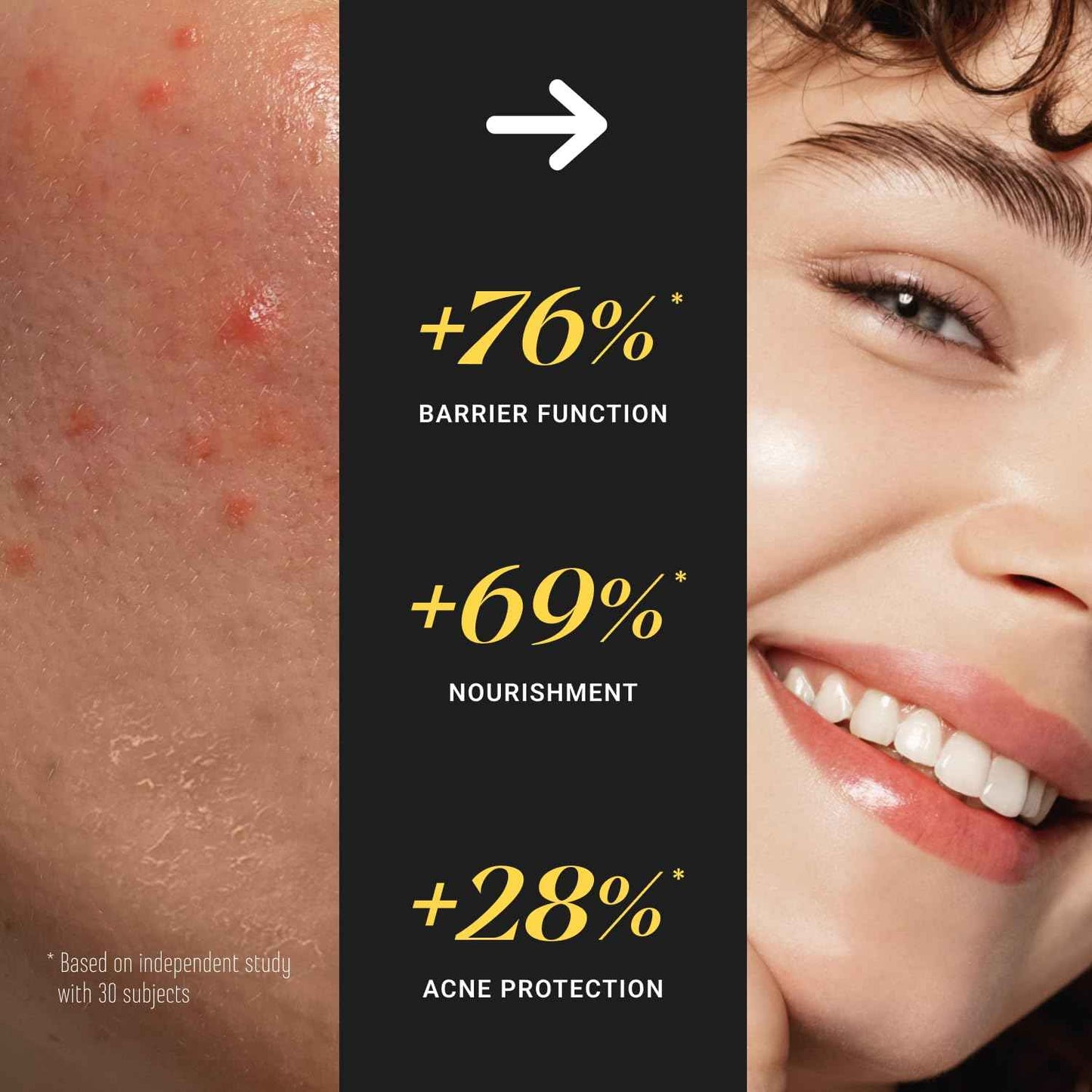 Non-Greasy Beef Tallow for Skin &Hair 5OZ Shea Butter, Vitamin E, Niacinamide, Whipped Grass Fed Beef Tallow for Face Moisturizer Cream, Lotion for Women & Men, Anti-Aging Face Moisturizer Leyo Rujera