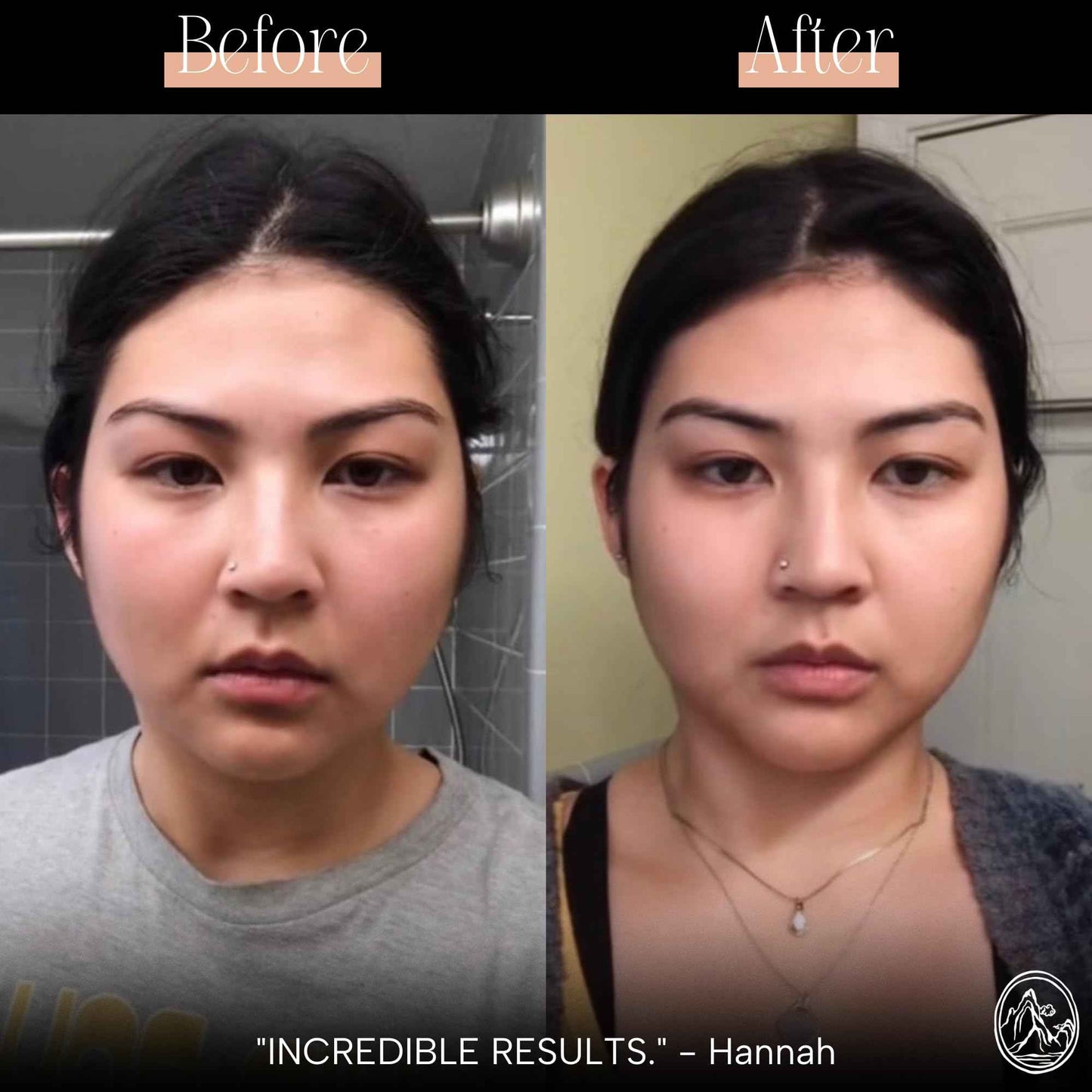 Mount Lai Obsidian Gua Sha Facial Tool – The Stone of Transformation – 100% Genuine Black Obsidian Stone Face Sculpting Tool for Lymphatic Drainage, Puffiness Reduction & Jaw Tension Relief