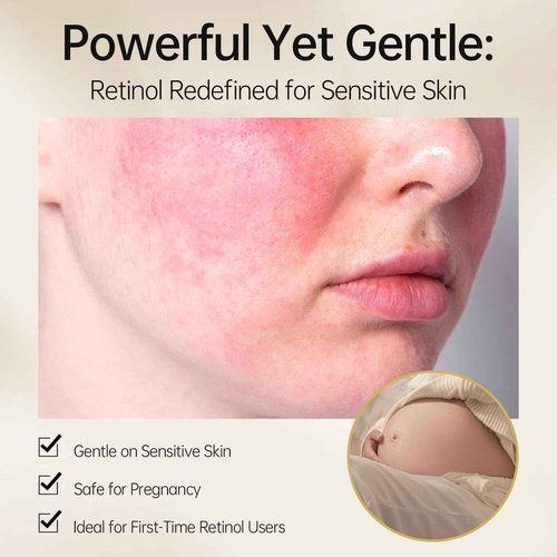 Bakuchiol Retinol Serum, 1% Retinol for Anti-Aging and Anti-Wrinkle, Gentle Yet Potent Formula for Sensitive Skin.