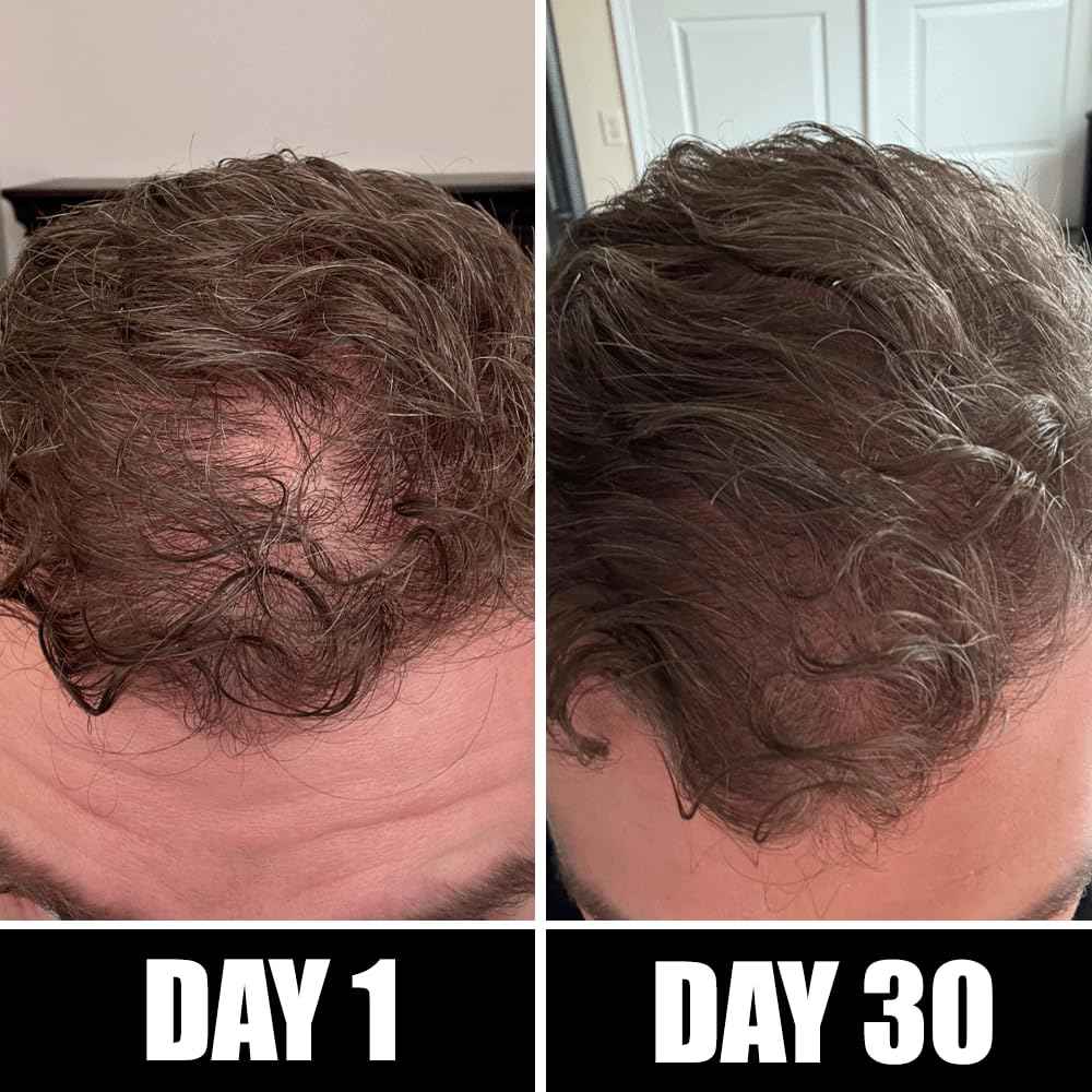 Pete & Pedro BOOST Hair & Beard Strengthening & Growth Natural Scalp Health Serum Oil For Men & Women - With Rosemary, Biotin & 20 plus Essential Oils | Shark Tank Featured, 2 oz.