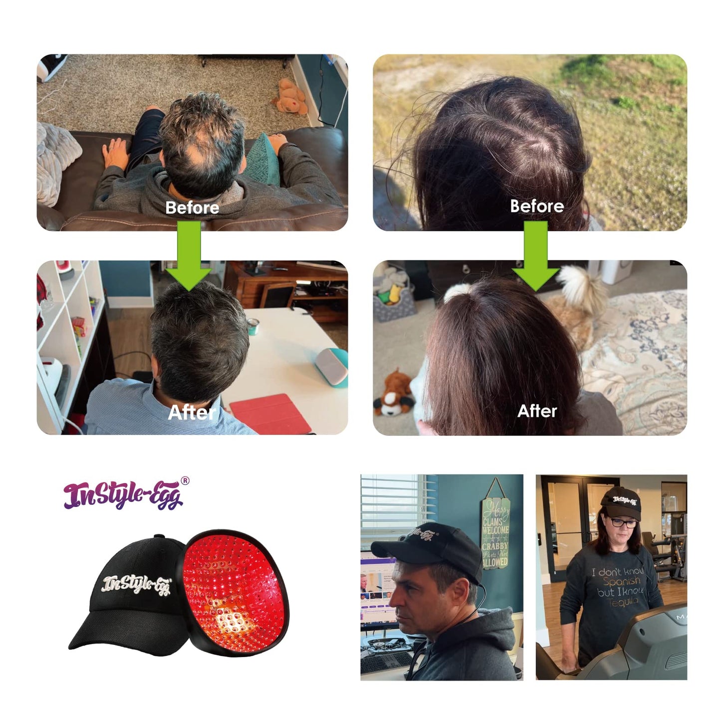 Instyle-Egg 272 Laser Cap for Hair Growth, FDA Cleared Hair Regrowth System for Men/Women, Scalp Treatment to Stop Hair Loss and Regrows Thinning Hair, Low Level Laser Therapy w/Medical Grade Lasers