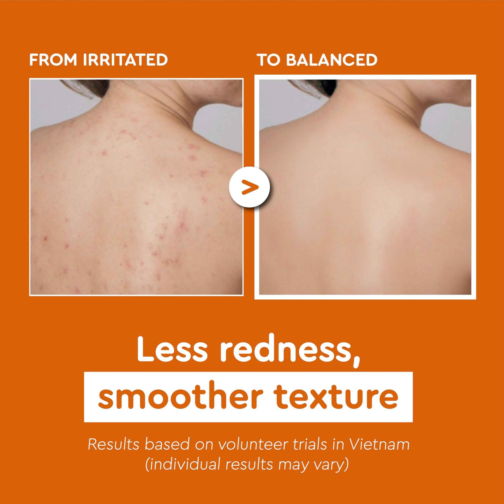 Vietnam's Touch | COCAY HOALA Ginger Turmeric Exfoliating Body Wash – Gentle Body Wash Sensitive Skin – Moisturizing & Nourishing Daily Shower Gel – Paraben & Silicone Free (17.64 oz)