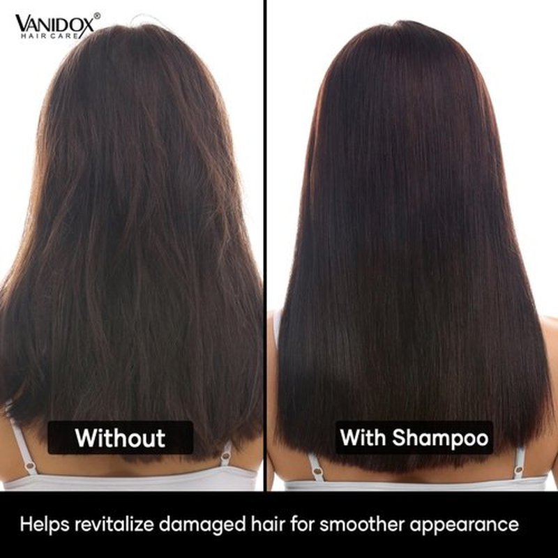 VANIDOX ReFortix Korean Shampoo and Conditioner Set, Enriched with Ginseng, Green Tea, and Camellia Oil, Supports Growth Stage and Helps Reduce Hair Loss for Stronger Hair (16 fl oz each)