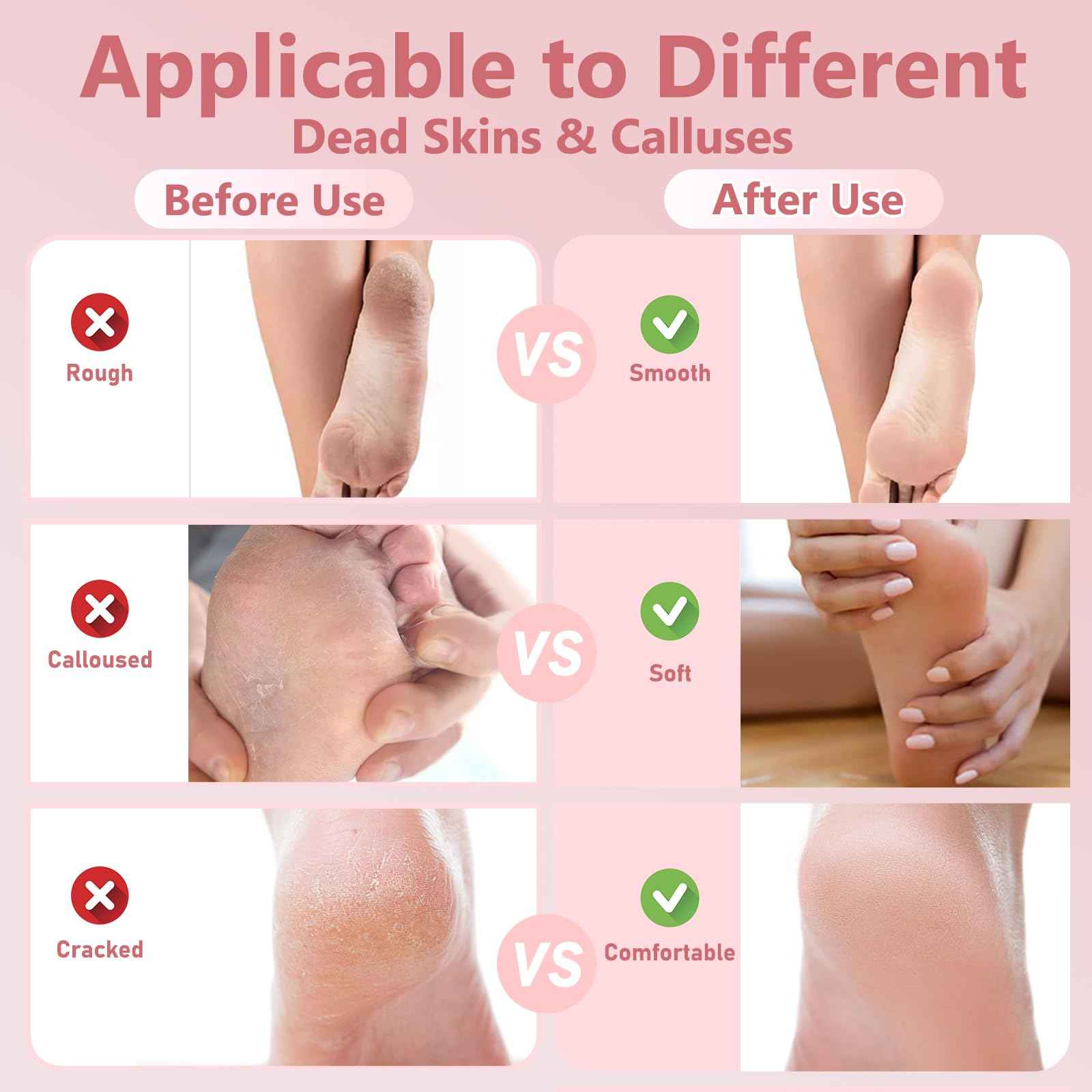 Electric Foot Callus File, Adjustable Speed Foot Grinder with 60pcs Reusable Sandpapers, Portable Foot Care Tool for Men & Women, Ideal for Home or Professional Pedicure Use (Pink)