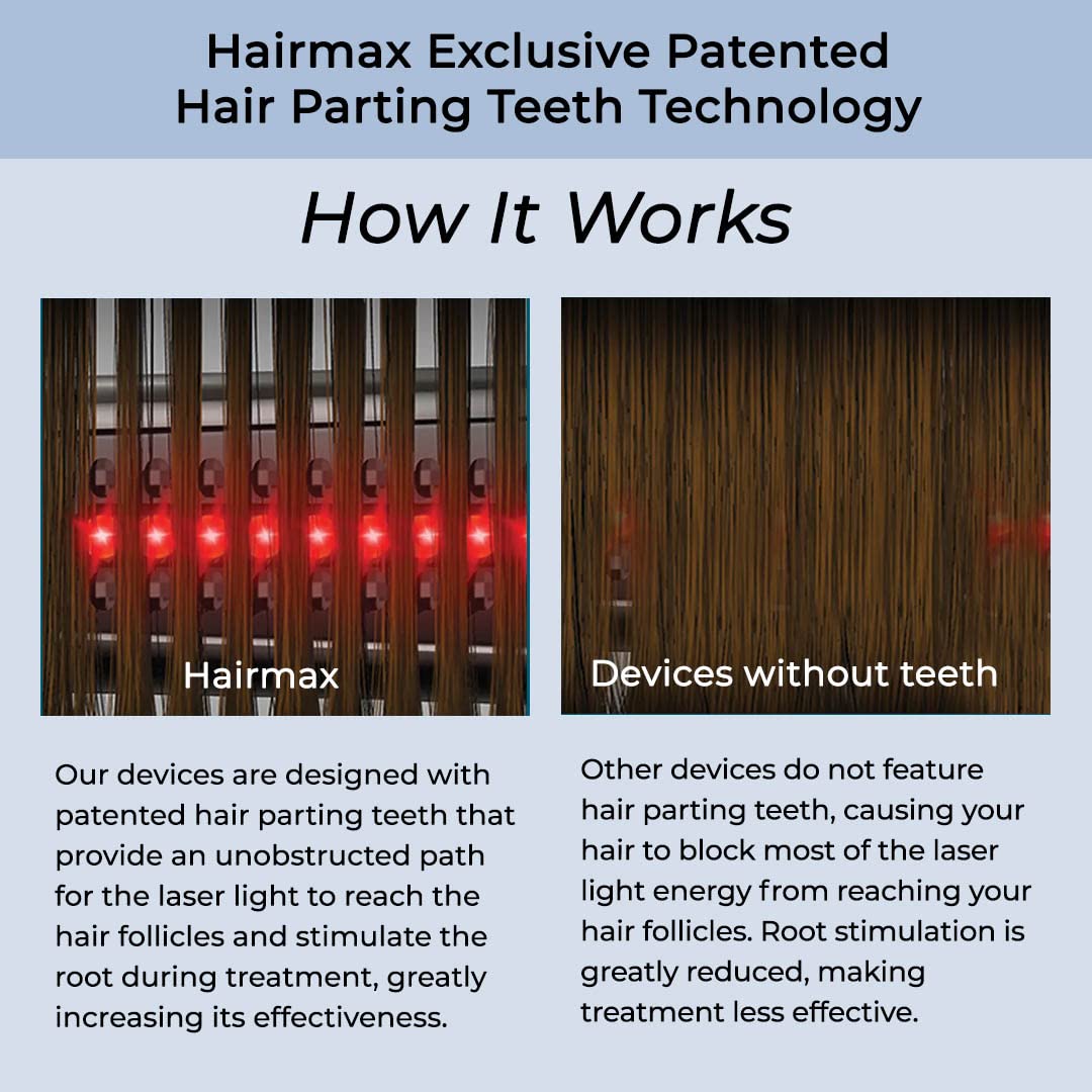 Hairmax Hair Growth Laser Band (FDA Cleared), LaserBand 82 ComfortFlex, Full/Partial Coverage, Hair Growth for Men & Hair Regrowth for Women, Hair Laser Growth, (100% Medical Grade Lasers, Not LEDs)