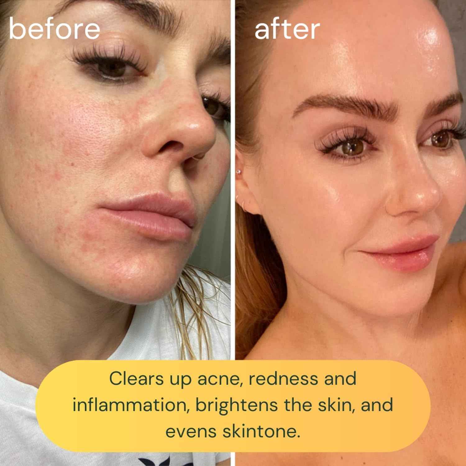 KOA LIFE Vit-C Brightening Facial Cleanser XL - Vitamin C Facial Wash, Skin Illuminating Face Wash, Gentle Foam Cleanser, Vegan - 3.38 Fl Oz