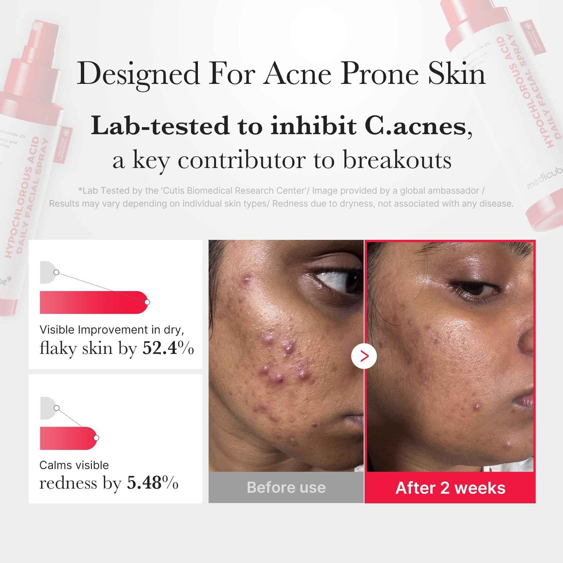 medicube Red Power Duo for After Spot Care Use: TXA+Niacinamide 15% Glow Facial Serum and Power Soothing Spray