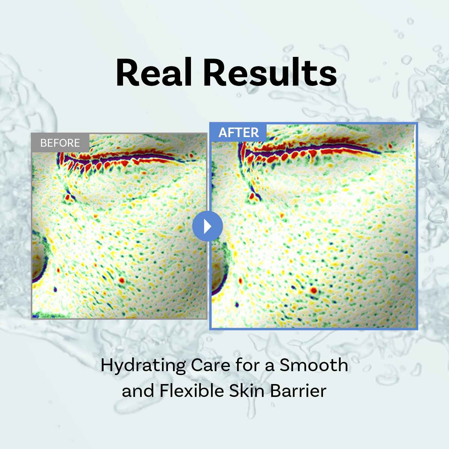 APOTHE Exosome Squal-Tox Booster Cream Mist 3.38 fl oz (100ml) – Hydrating, Soothing, and Brightening with Squalane, Centella Asiatica, and Niacinamide