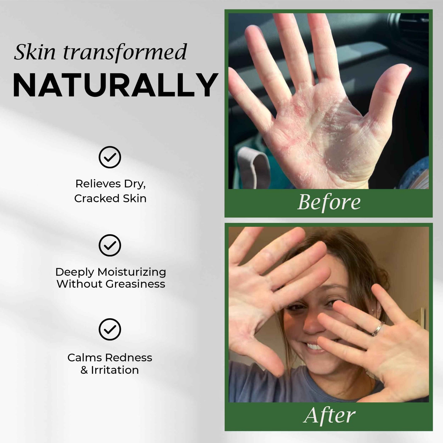 Greenstead Naturals Organic Beef Tallow for Skin – USDA-certified Whipped Tallow Balm for Skin Face and Body with Jojoba Oil and Cocoa Butter – Unscented and Herb-Infused – 2 oz.