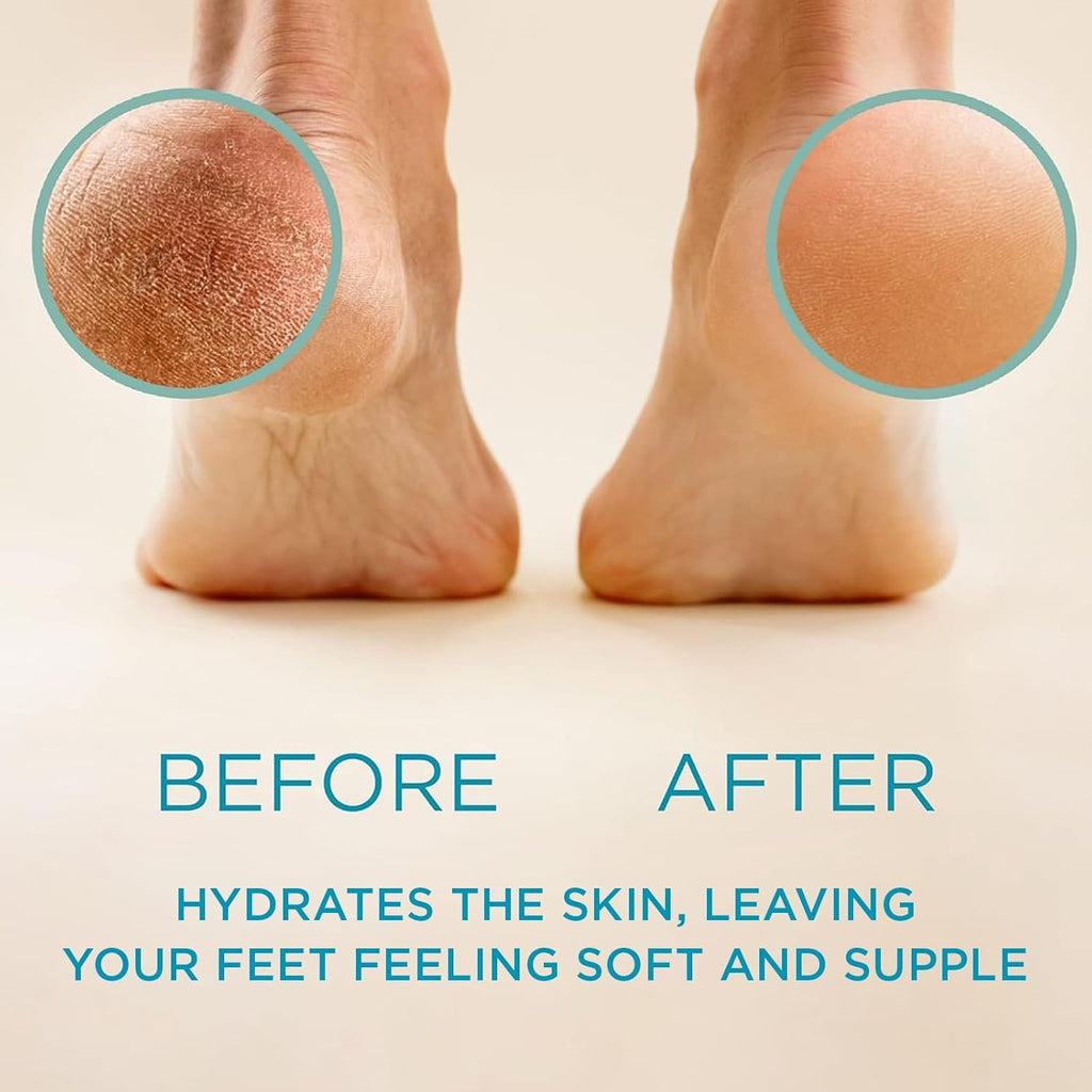 Lee Beauty Professional Callus Remover for Feet - Original, Powerful Formulation - Extra Strength Gel, Home Pedicure Foot Spa Results - Cracked & Dead Dry Skin Supplies - 8 Oz