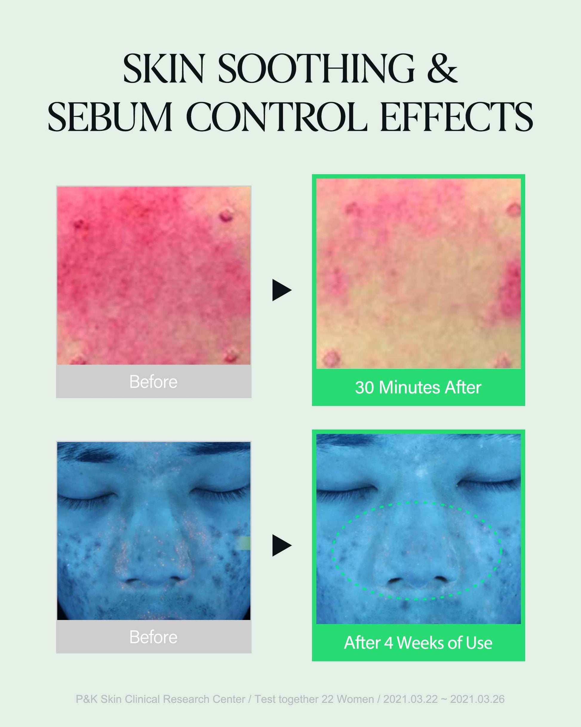 About Me SOOP Calming Aqua Cream – Korean 77.7% Jeju Cypress Water 100 Hour Moisture Cream for Sensitive Acne Skin – Daily Jelly Texture with Niacinamide – Korean Skin Care – 2.87oz, 85ml