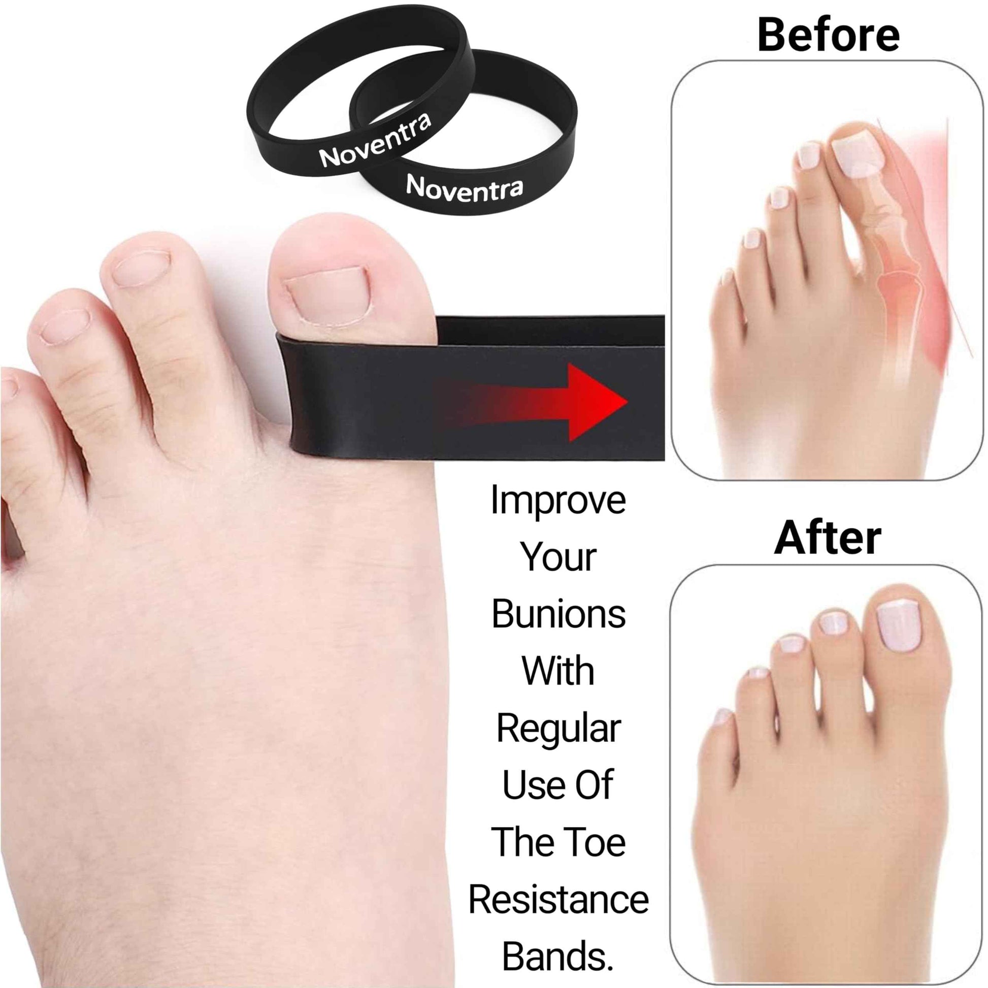 Foot Recovery Kit - Toe Spacers, Cork Massage Ball & Resistance Bands for Plantar Fasciitis Relief, Bunion Correction, Foot Pain, Yoga & Stretching - Post Workout Massage - Travel Pouch Included