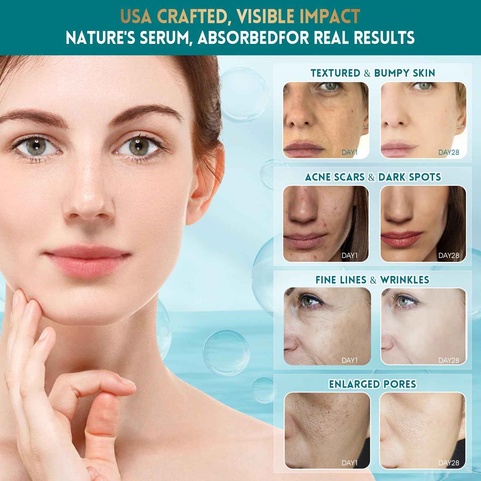 HOLYOM Snail Mucin Face Serum with Hyaluronic Acid – Anti-Aging Facial Serum for Fine Lines, Wrinkles & Dull Skin – Hydrating & Firming Essence for All Skin Types, 1.18 fl oz