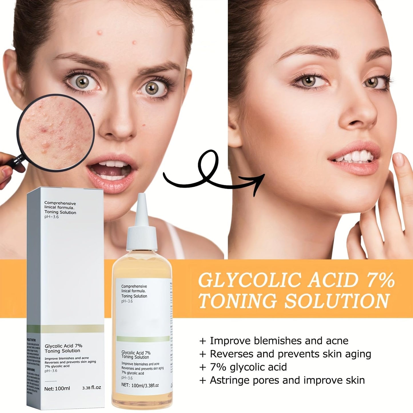 Glycolic Acid 7% Toner, Glycolic Acid 7% Toning Resurfacing Solution, Facial Exfoliation Astringe Pores, Blemishes and Acne. (240 ml)