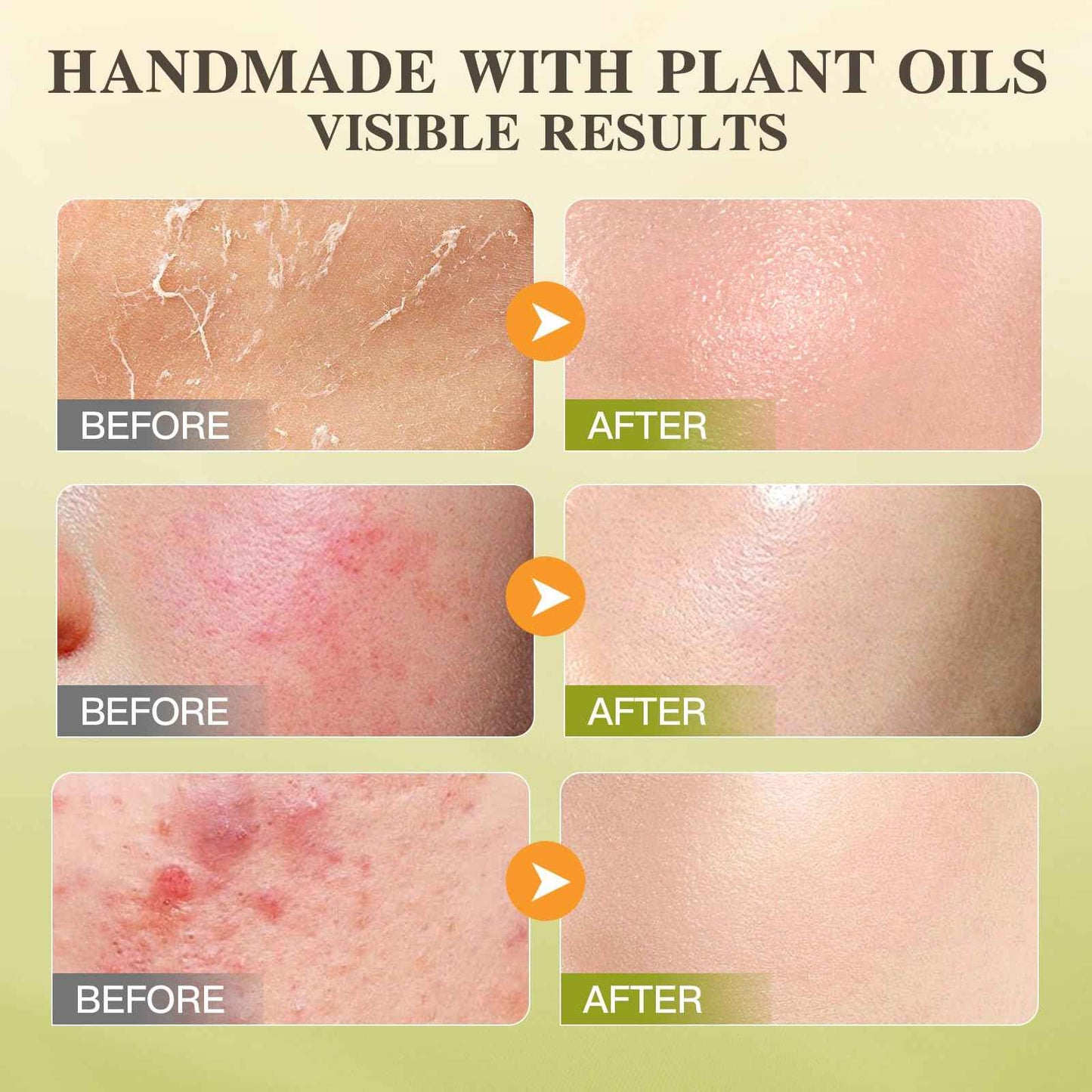 Organic Beef Tallow Honey Balm, Whipped Moisturizer for Face and Body, Grass Fed Beef Tallow for All Skin, Safe Natural Edible Grade Ingredients, Pure Unscented Cream, Day Night Skincare, 5.3 oz