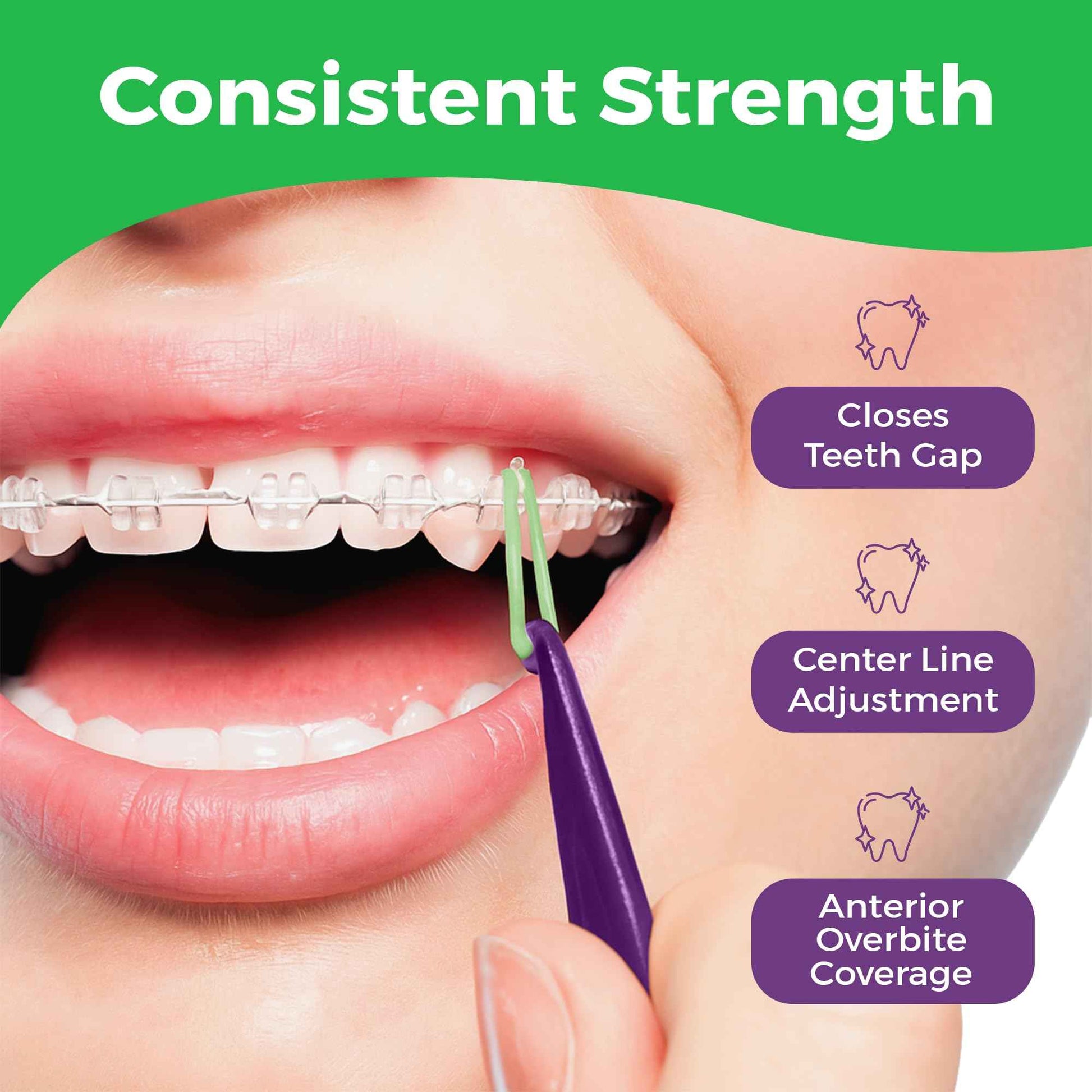 Orthodontic Rubber Bands for Braces - Premium Quality Elastic Teeth Rubber Bands for Braces, Fix Tooth Gaps, Dreadlocks, Includes Free Elastic Placer - Medium Force 3.5 oz, 1/8 Inch, Neon (500 Pack)