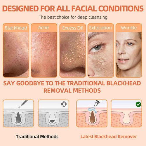 2025 Pore Vacuum, USB Rechargeable Blackhead Remover Vacuum,3 Levels Adjustable Pore Vacuum Blackhead Remover, with 6 Suction Power Probe,4 Golden Needle face Vacuum Pore Cleanser Kit-White