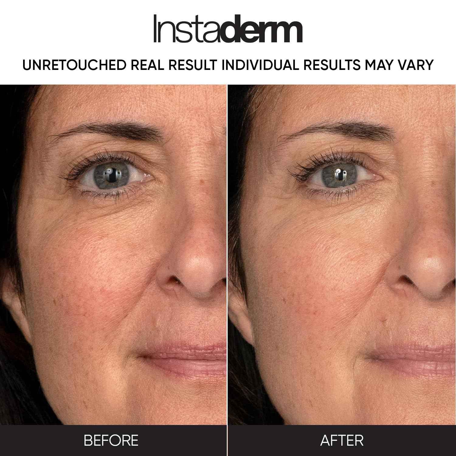 Retinol Skin Booster Cream- Age-Defying formula That Visibly Reduce The appearance of Fine Lines & Wrinkles. Improve Firmness, Elasticity, Thickness Of The Skin & Evens skin Tone.