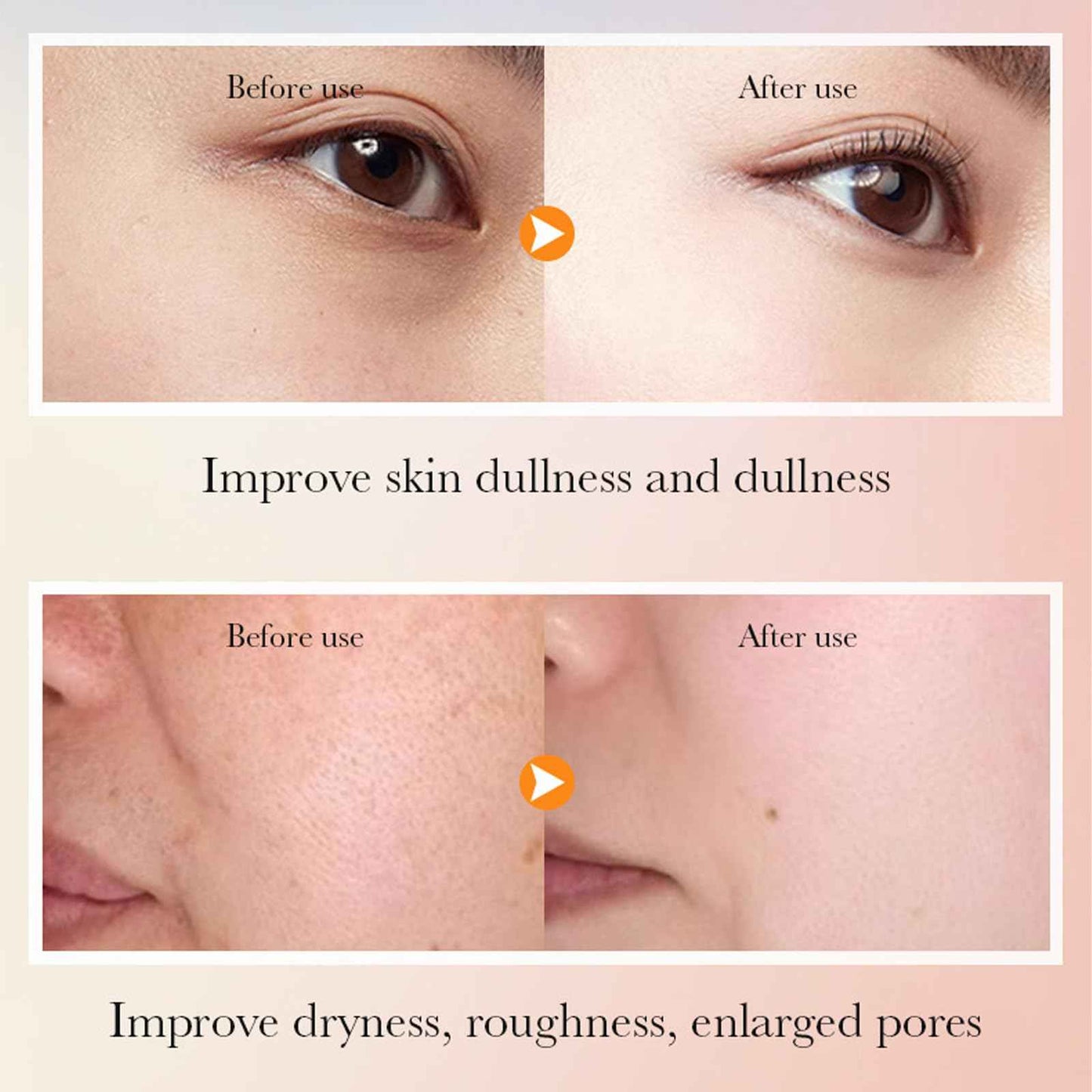 6 Piece Hydrating Skincare Gift Set for Women, Vitamin C Face Care Kit Includes Cleanser, Toner,Serum,Eye Cream,Moisturizer & Body Lotion for Teen Girls Daughter Mother's Day Christmas Birthday Gifts