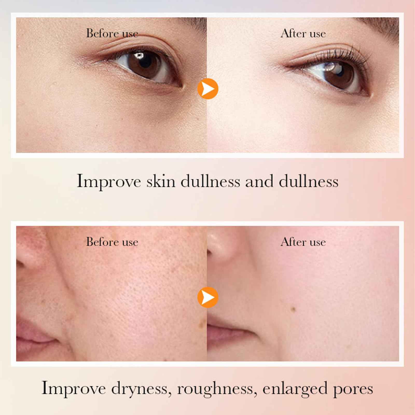 6 Piece Hydrating Skincare Gift Set for Women, Vitamin C Face Care Kit Includes Cleanser, Toner,Serum,Eye Cream,Moisturizer & Body Lotion for Teen Girls Daughter Mother's Day Christmas Birthday Gifts