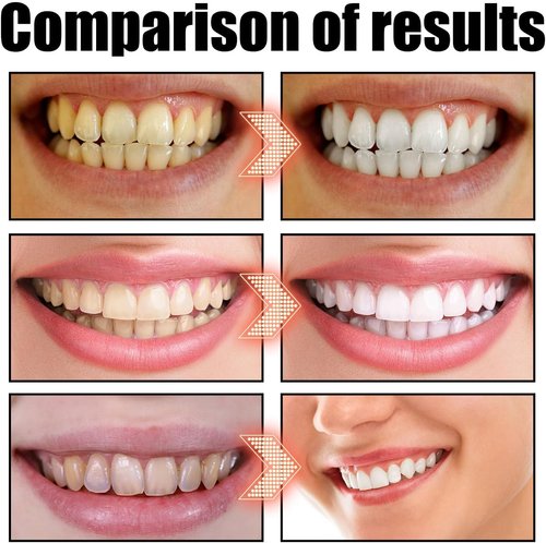 Coconut Oil Pulling for Teeth, Cocofresha Coconut Oil, Coco Fresha Pure Organic Coconut Oil Pulling 4 Oz Mint Flavor, Cocofresha Pulling Oil for Teeth and Gums