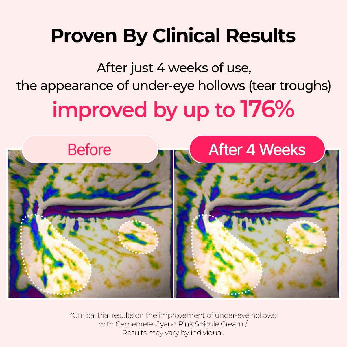 Dr.Melaxin Cemenrete Cyano Pink Spicule Cream with Calcium, Vitamin B12 for under eyes skin, Dark Circles, Fine Lines, Puffiness&Eye Bags Cream, 1.69 fl. oz.