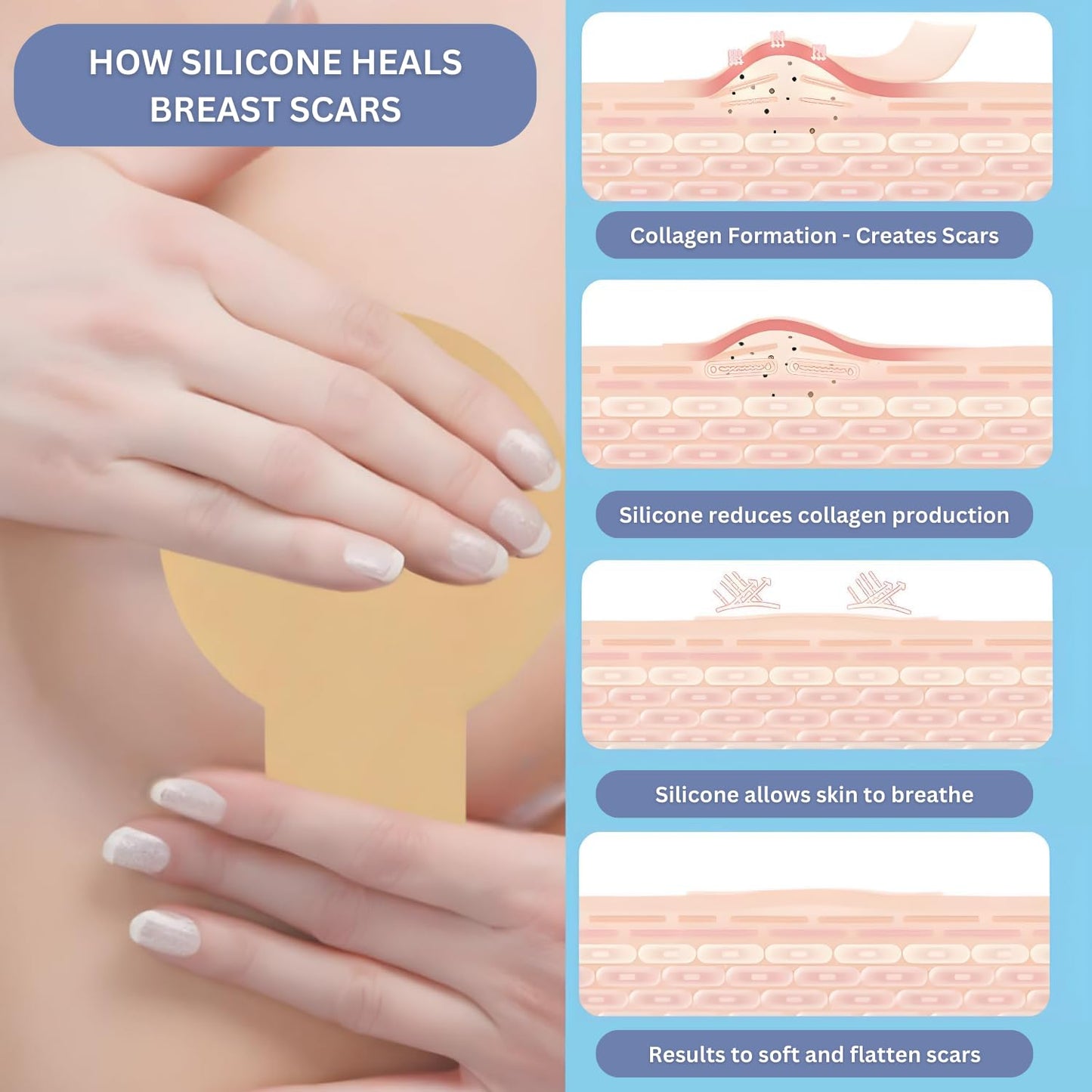 Breast Augmentation Must Haves Post Surgery - Breast Reduction Recovery Supplies After Surgery Needs - Silicone Scar Sheets for Surgical Scars - Comfortable Under Post op Bra (4PCS)…