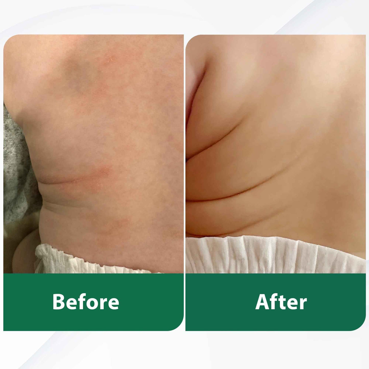 DERMOIA Grass Fed Whipped Beef Tallow for Skin with Manuka Honey - Silky Smooth, Fast Absorbing Tallow & Honey Balm - Ideal for Kids & Eczema Prone Area - Whipped Moisturizer for Dry & Sensitive Skin