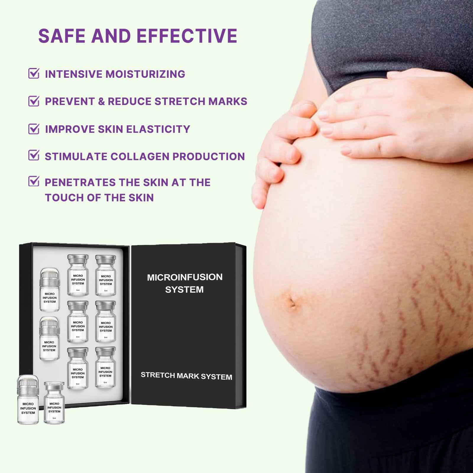 Stretch Mark System, Infused with Collagen and Elastin Support – Hydrating & Nourishing Formula for Smoother Looking Skin (1)