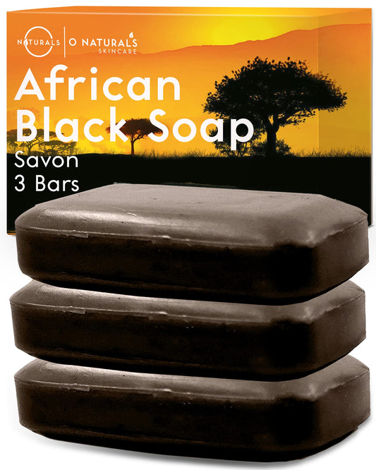 O NATURALS Organic African Black Soap Bar 3PC - Rich in African Shea Butter - Helps Acne Prone Skin - Natural Body Wash & Face Wash - Black African Soap - Natural Black Soap Bar for Women & Men