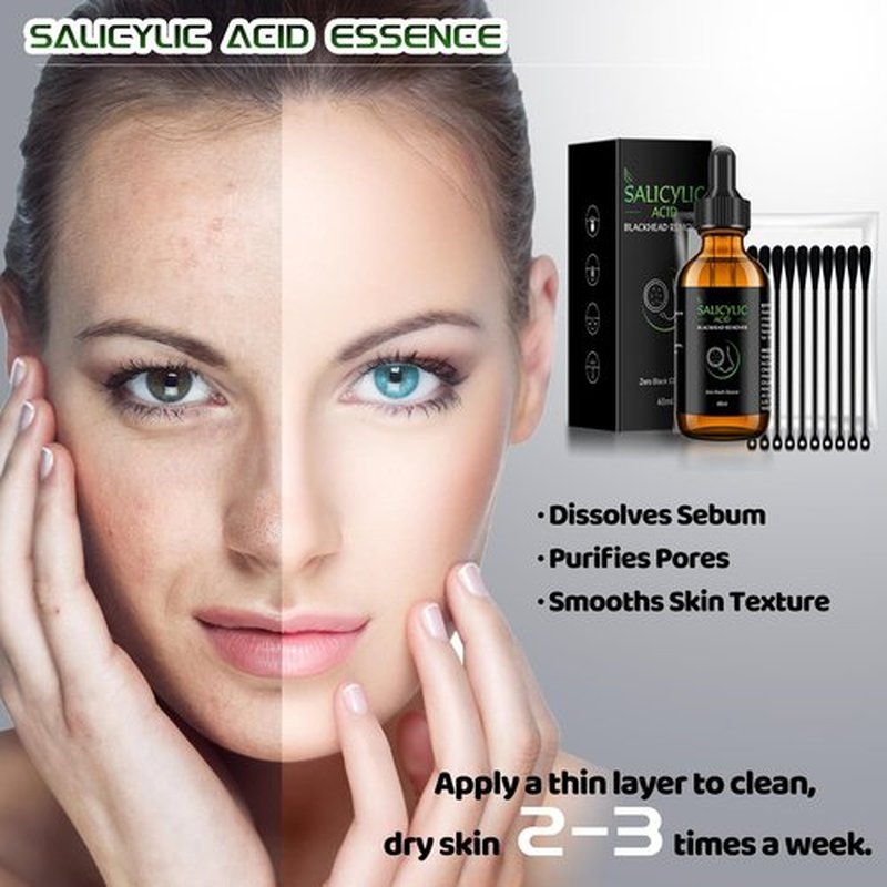 Salicylic Acid Serum, 60ml Blackhead Remover Essence and 25 Pcs Nose Pore Strips, Deep Cleansing Dirts, Pores, Skin Oil, Purifying Peeling, Black White Head Acne Removal for All Skin Type