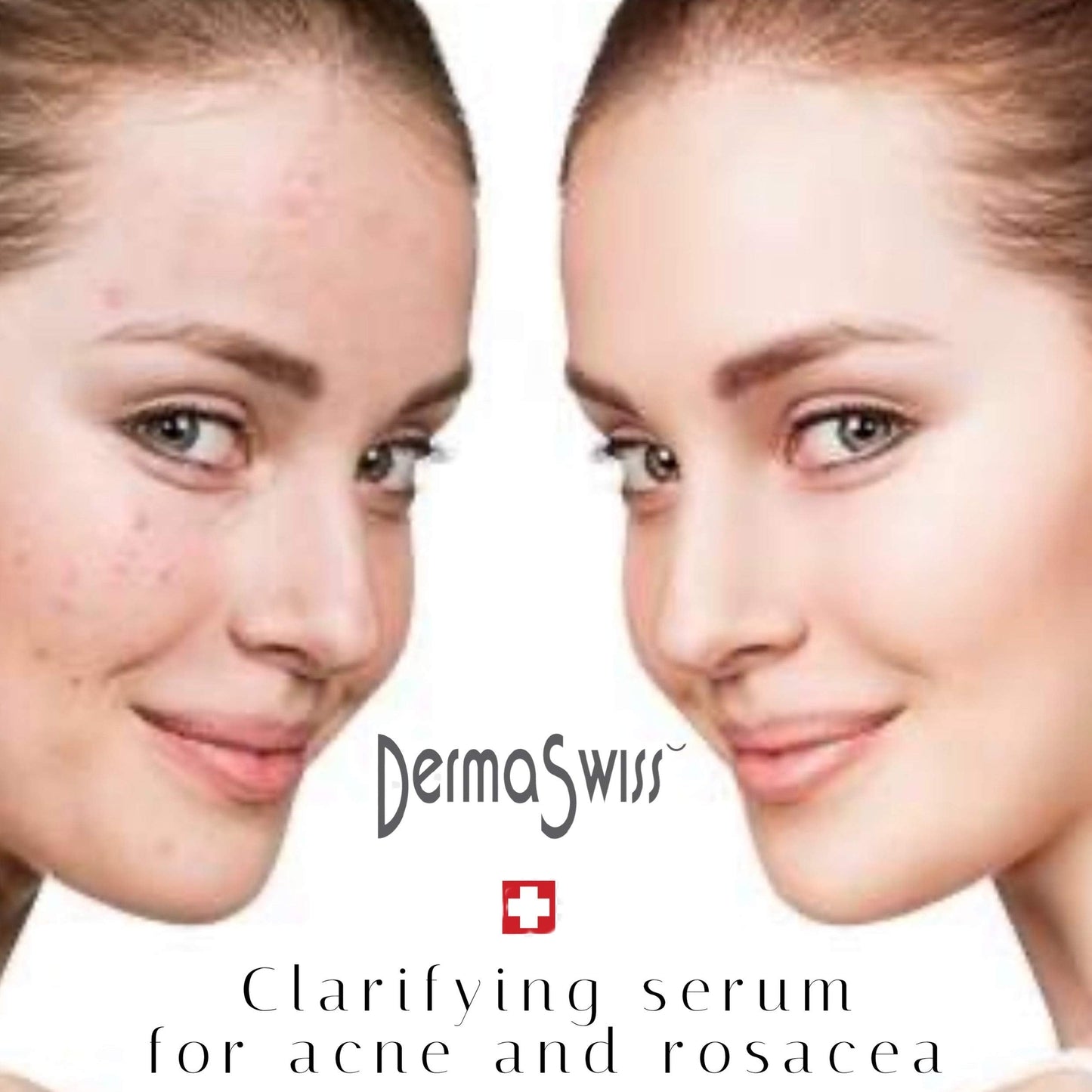 Clarifying Face Serum - Derma Swiss Control Skincare Clarity- Acne Spot Treatment Essential Serum for Day and Night with Probiotics, Moisturizer Skin.