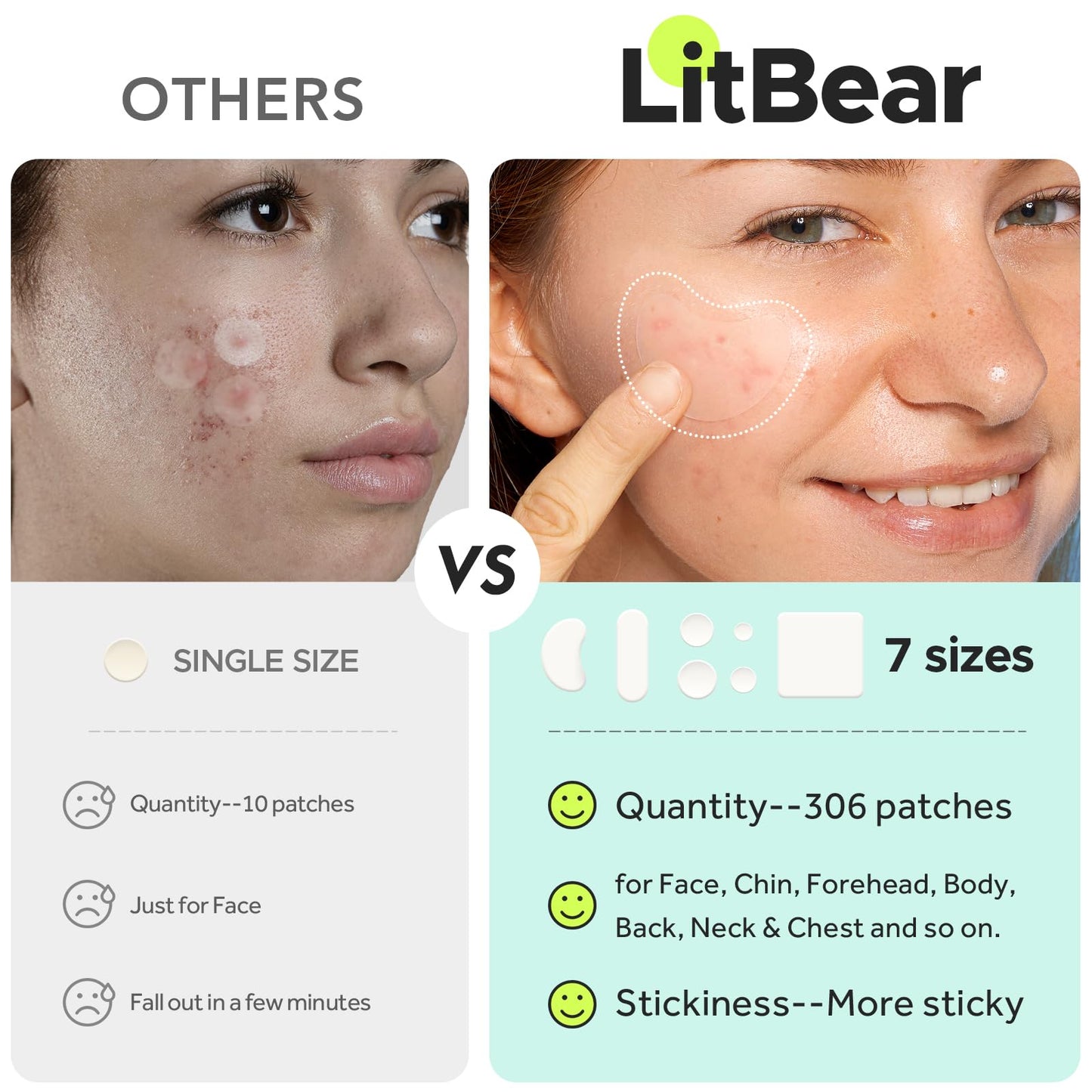 LitBear Large Pimple Patches (7 Sizes 306 Patches), Big Acne Patches, XL Hydrocolloid Bandages for Full Face, Forehead, Chin, Nose, Body, Back, Neck & Chest, Oval, Moon, Square hydrocolloid Patch