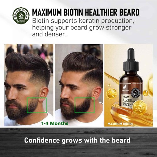 aokur Biotin Beard Growth Oil for Men - Vitamin B5 & Castor Oil Formula, Promote Thicker Fuller Beard, Daily Care, Styling & Taming, Hydrating, Lightweight Non-Greasy, Vanilla 2oz Gift for Him