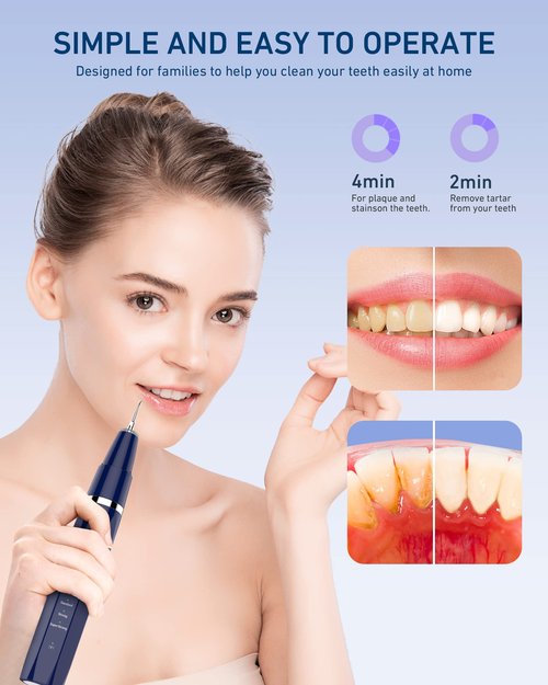 Plaque Remover for Teeth, Tartar Remover for Teeth with LED Light, Dental Calculus Remover Teeth Cleaning Kit