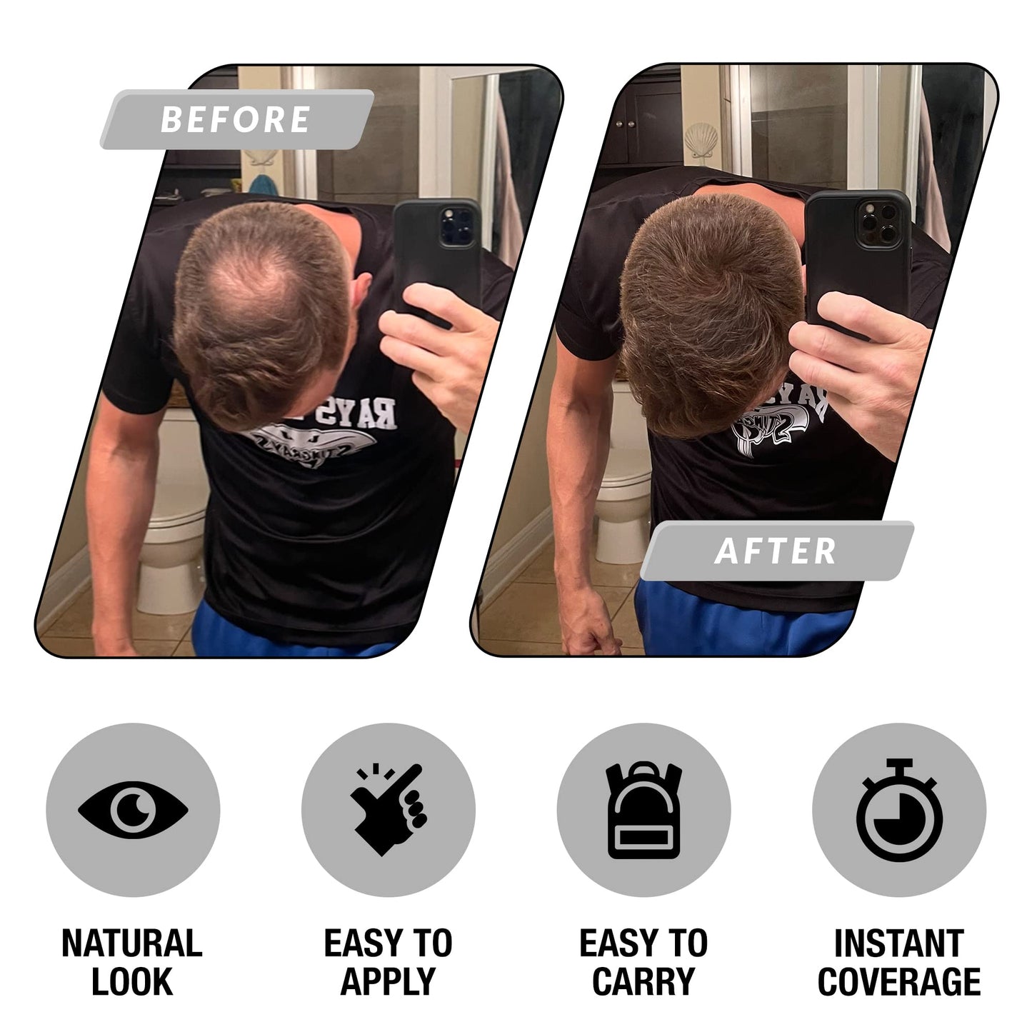 Hair Building Fibers For Thinning Hair for Men - Hair Fillers Powder - Hair Thickener For Thinning Hair for Women - Bald Spot Cover Up - Hair Loss Scalp Concealer Powder Fillers by No More Bald Spot