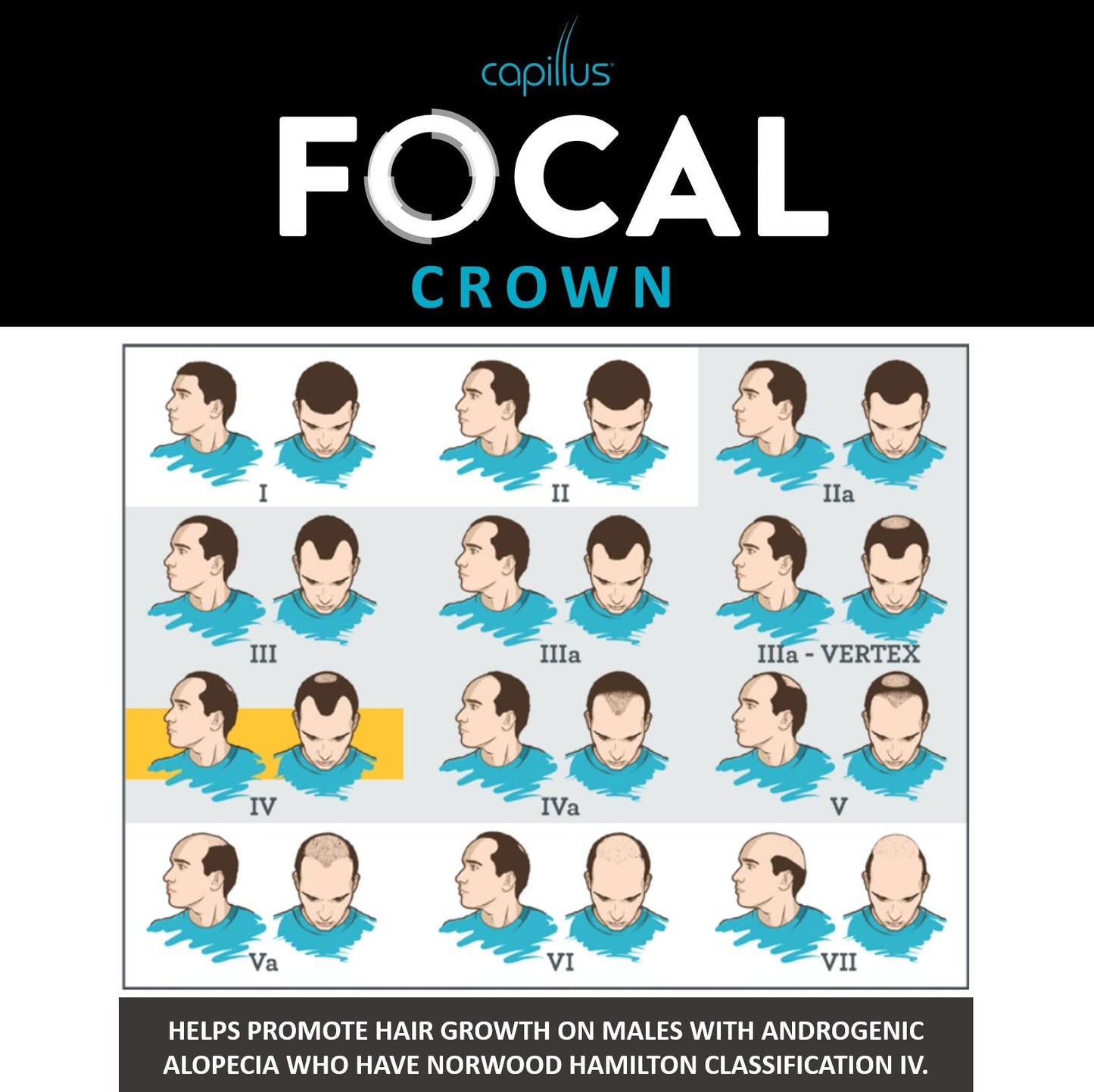 Capillus FOCAL CROWN Hair Laser Growth Cap, Exclusively Designed for Men, FDA Cleared for localized hair growth in the crown in your head.