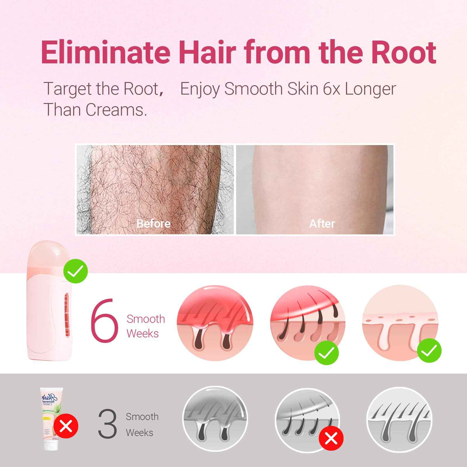 Waxpro Roll On Wax Kit for Women - Easy to Use - At-Home Hair Removal for Body (Arms & Legs) with 2 Honey Wax Roller Cartridges & 50 Strips (Pink)