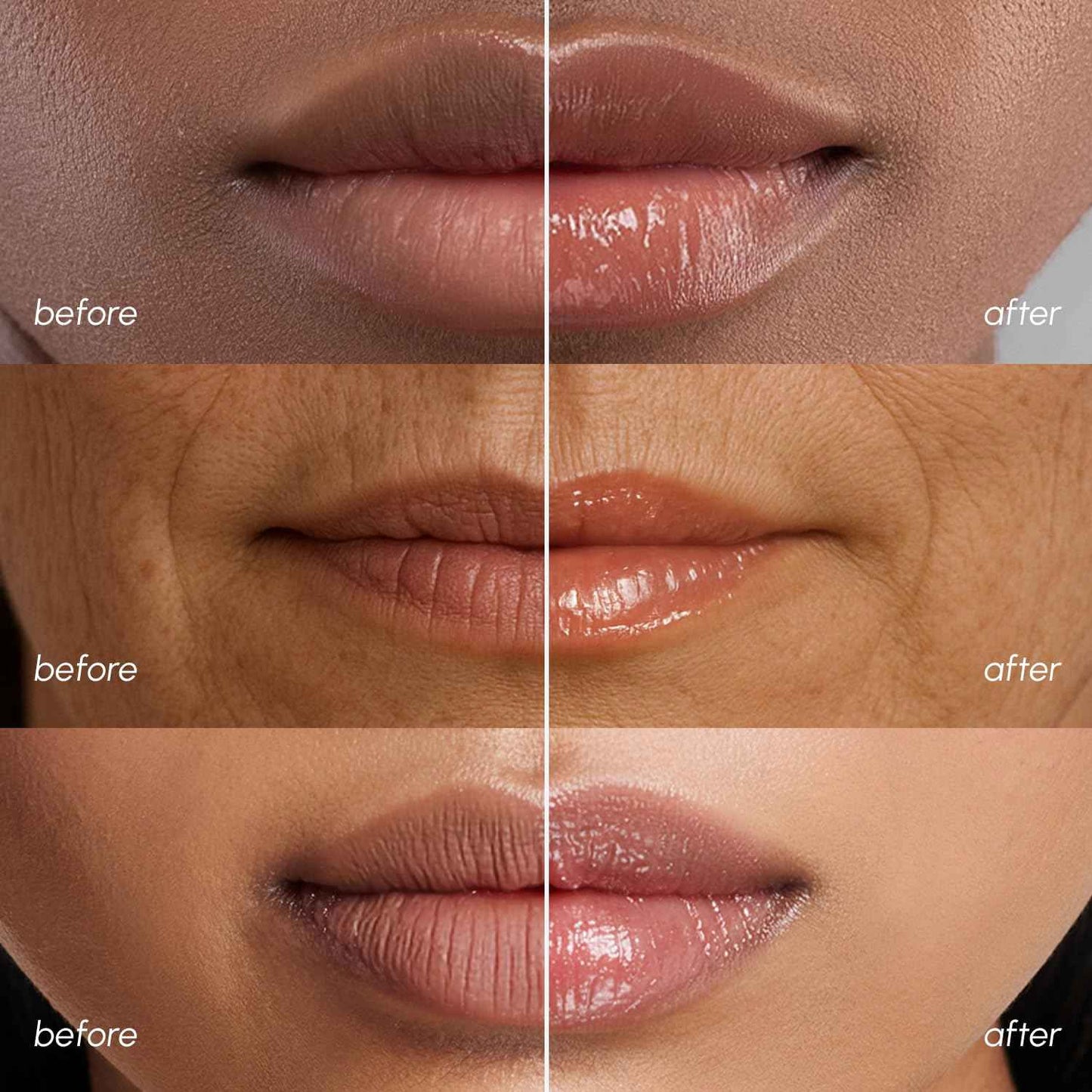 MAREE Lip Mask Overnight 2 Pack - Lip Moisturizer For Very Dry Lips - Hydrating Lip Butter Balm with Hyaluronic Acid & Collagen - Overnight Lip Treatment - Lip Sleeping Mask Repair