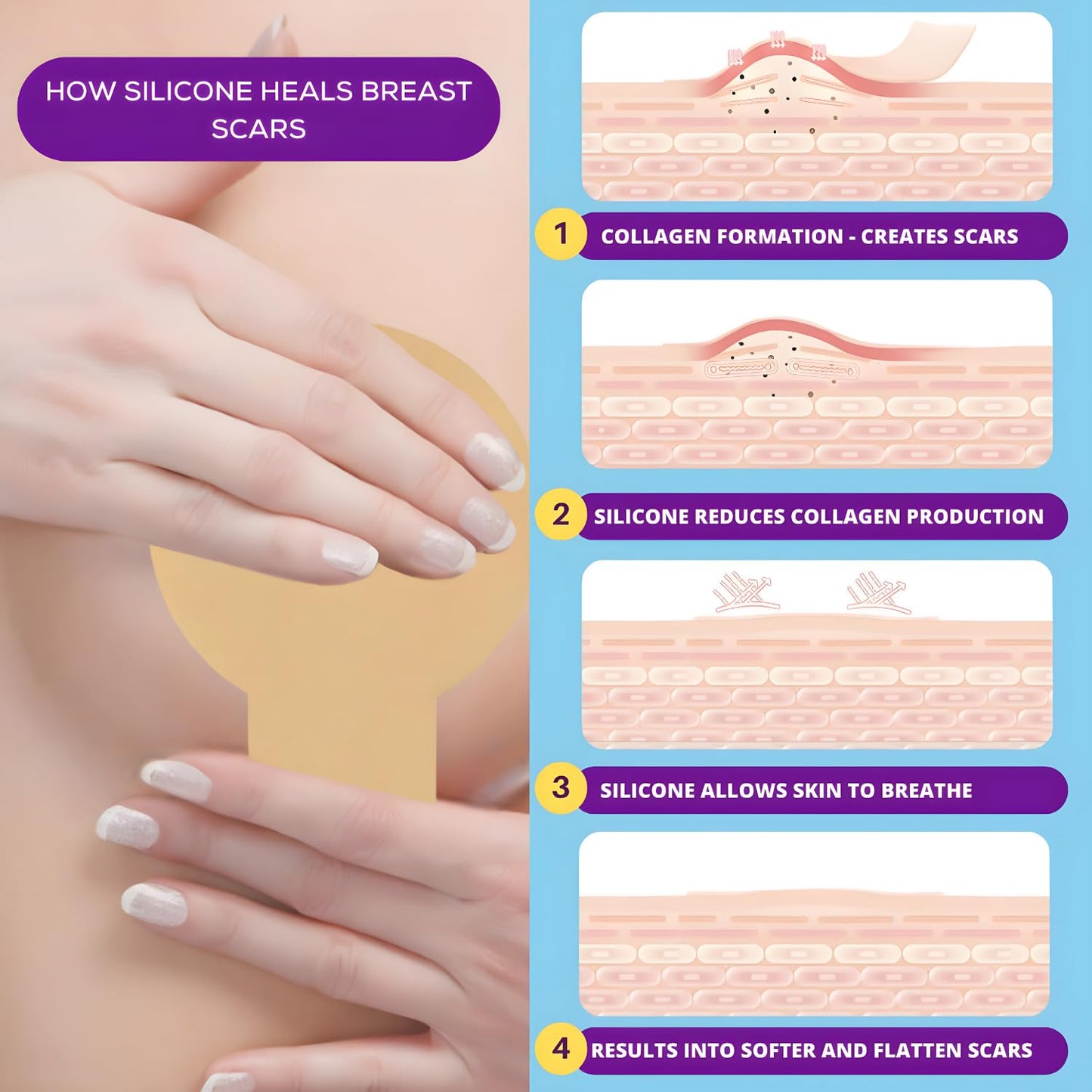 Breast Silicone scar sheets - Silicone scar sheets for surgical scars - Comfortable under Post op Bra (2PCS)