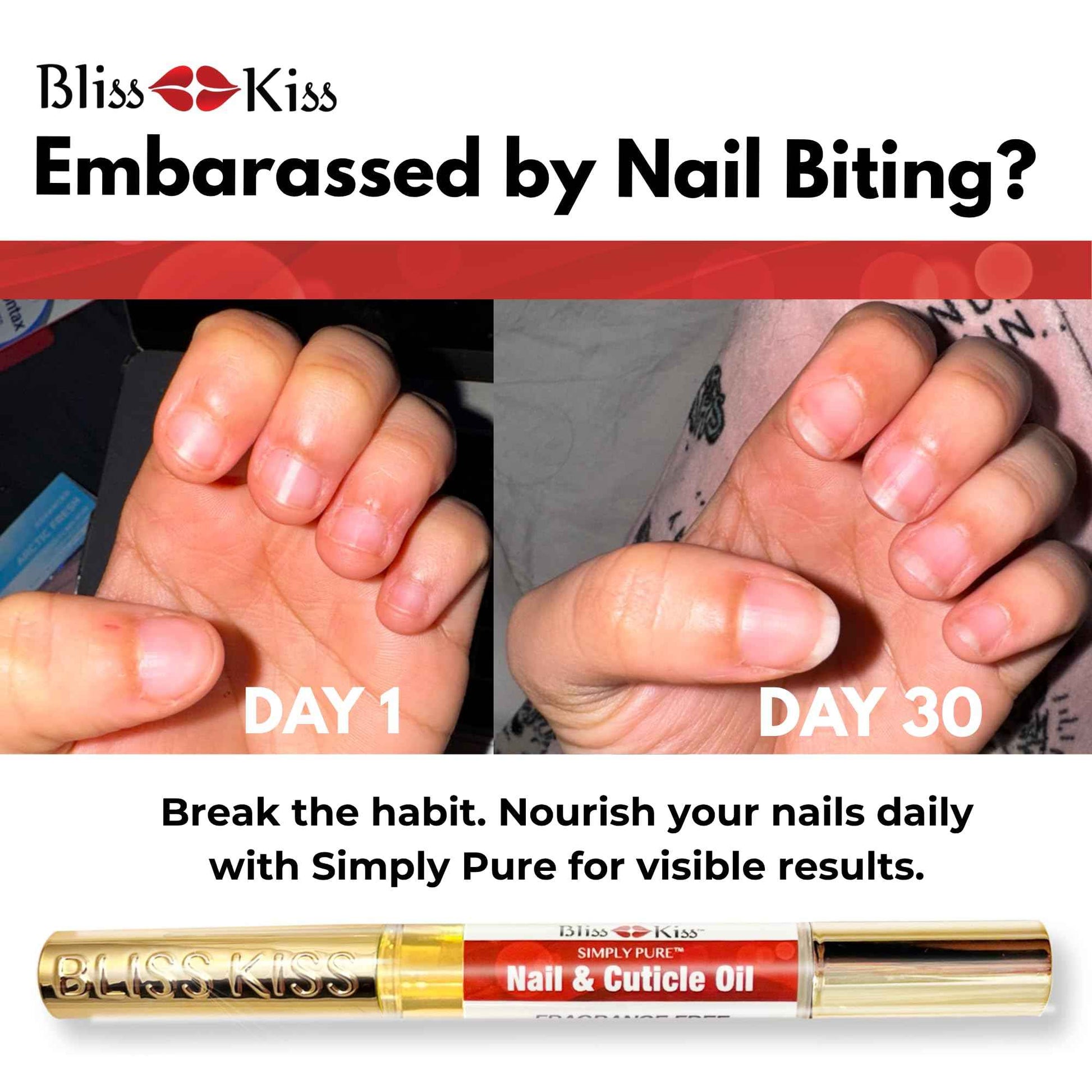 Bliss Kiss | Fragrance Free 4 Nail Oil Cuticle Pens w/Vitamin E & Jojoba⏤Nail Strengthener Nail Growth and Strengthening Serum for Brittle, Peeling, Breaking, Thin nails