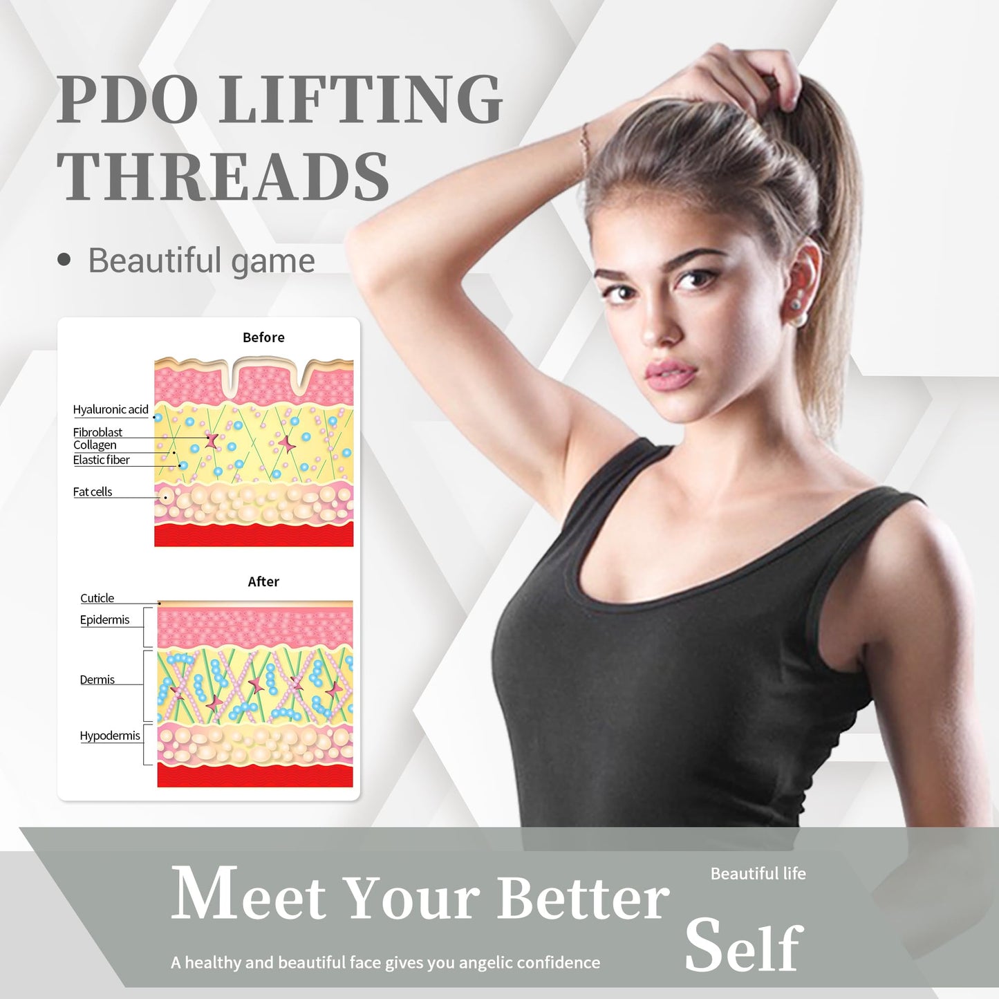 HYPOD Pdo Threads Lift, Pdo Lifting Thread for Whole Body Mono Screw Type, Stimulates Collagen Regeneration 20PCS-30G*20MM