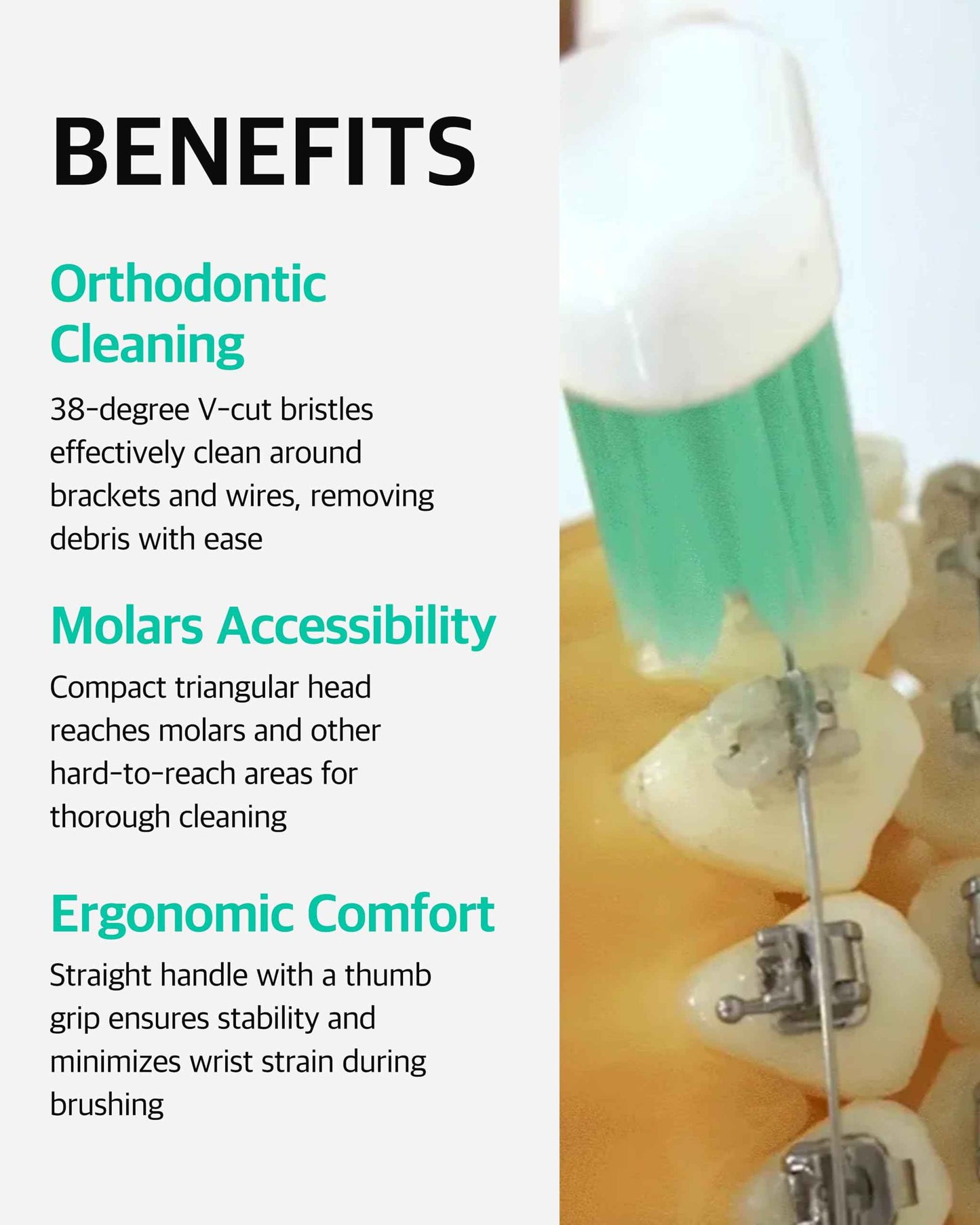 LiveOrals V-Cut Orthodontic Toothbrush (Mint 3 Units + White 3 Units) - Compact Head for Braces, Ergonomic Handle, Deep Cleaning, Gentle Bristles for Brackets and Wires