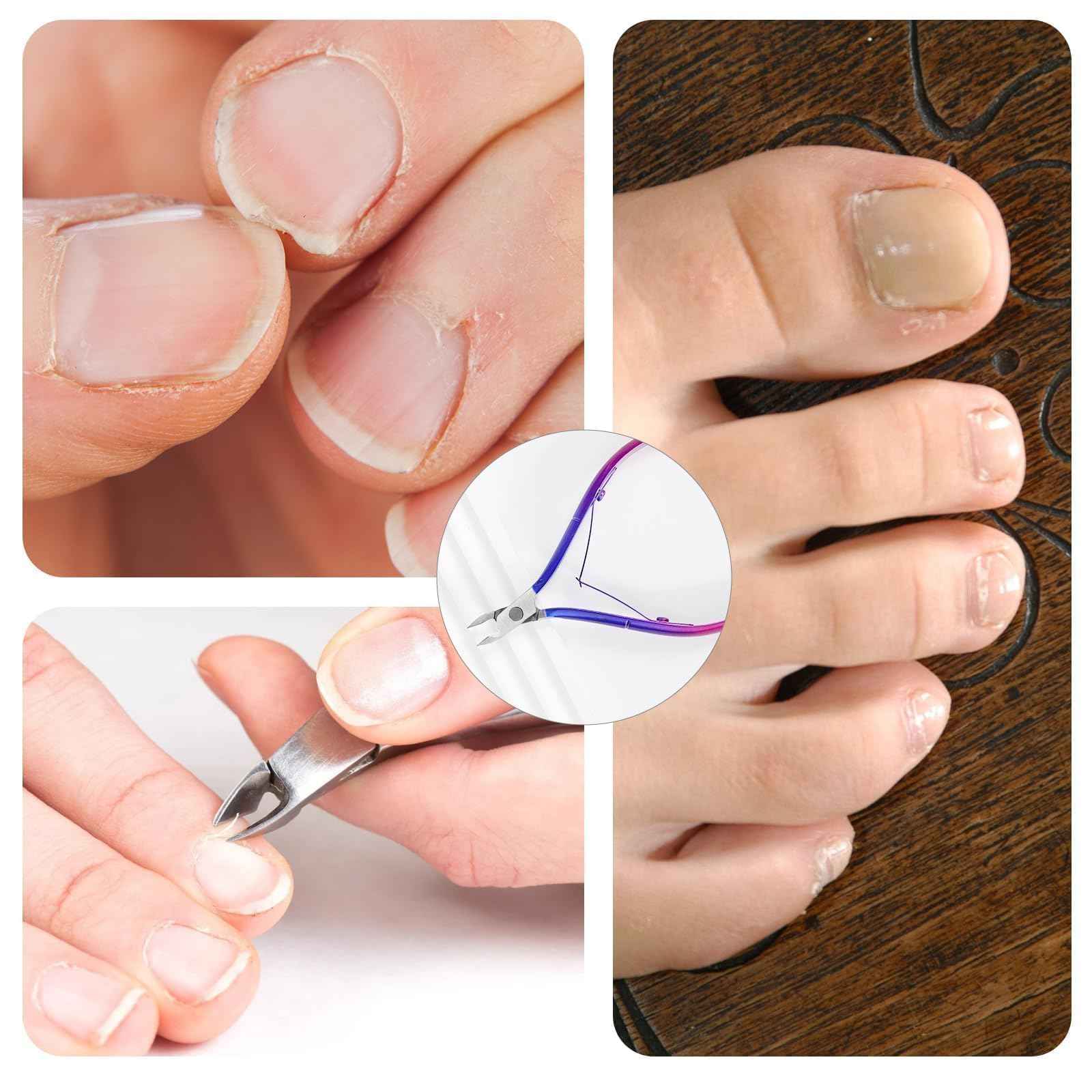 Criyar Cuticle Nippers Kit: Precision Nano-Coated Stainless Steel Cuticle Trimmer Remover for Fingernails and Toenails, Cutter for Manicure Pedicure, Nail Clippers Tools for Women (Blue-Color 1PC)