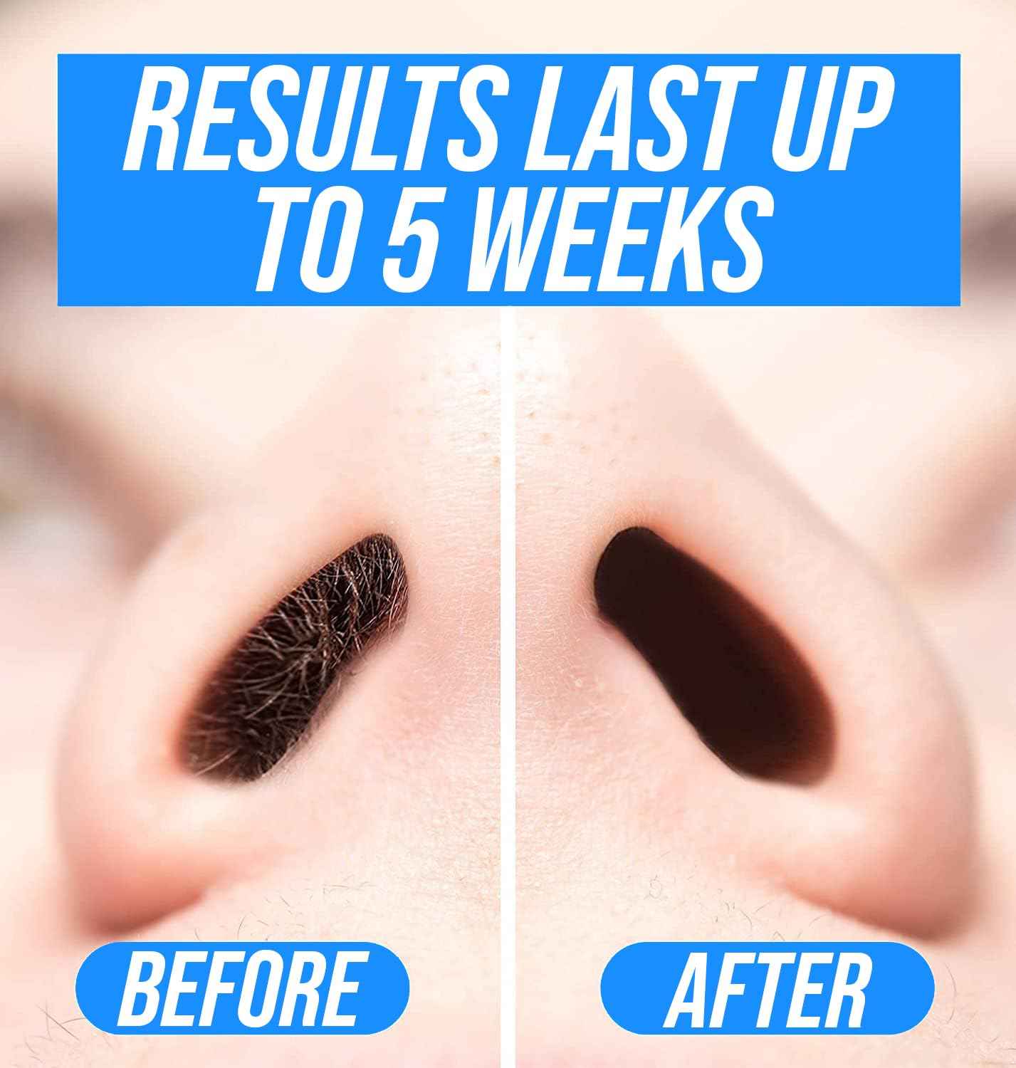 Kenashii Super BUNDLE Nose & Ear Hair Removal Kit | 100 g Wax, 84 Applicators | No Microwave Needed | Nasal Waxing For Men and Women | 12 Balm Wipes, Mustache Guards, Storage Bag