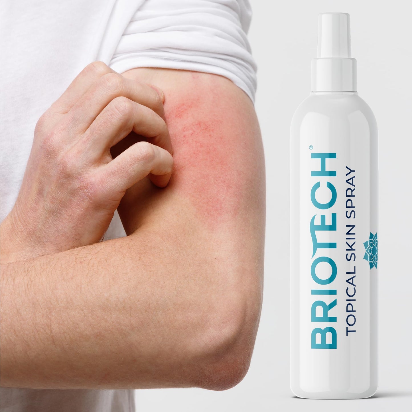 BRIOTECH Topical Skin Spray, Hypochlorous Acid Spray for Body & Face, Eyelid Cleanser, HOCl Facial Mist, Support Against Irritation, Calm Redness, Soothe Foot & Scalp, Packaging May Vary, 4 oz, 1 ct